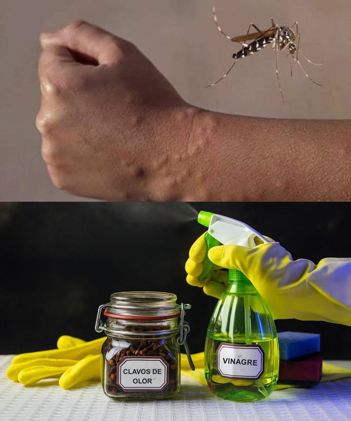 烈 Dile adiós a los mosquitos con este spray casero natural 

 El verano trae luz, aire fresco y mosquitos molestos. Pero no necesitas aerosoles tóxicos. Con solo 2 ingredientes, puedes crear un repelente eficaz, económico y completamente natural.

林 Spray anti-mosquitos con vinagre y clavo
Seguro para toda la familia, mascotas incluidas 

 Ingredientes mágicos:
籠 1 cucharada de clavo molido
林  litro de vinagre blanco
龎 Botella con atomizador limpia

 Preparación exprés:

Coloca el clavo molido en la botella.

Añade el vinagre.

Agita bien para que se mezcle todo.

 Cómo usarlo:
Rocía en alféizares, marcos de puertas, rincones oscuros y debajo de camas.
Hazlo antes de dormir para dormir sin picaduras.
Repite a diario si es necesario.

易 Por qué funciona tan bien?
 Clavo: el eugenol aturde el olfato de los mosquitos.
 Vinagre: su olor ácido actúa como barrera repelente y además desinfecta.

 Beneficios extra:
 100% natural
 Apto para usar cerca de bebés, mascotas y alimentos
 Sin químicos, sin tóxicos, sin complicaciones

 Resultado:
Nada de picaduras.
Nada de zumbidos.
Solo descanso y tranquilidad toda la noche.

Hazlo esta noche y despierta con una sonrisa, no con ronchas. 烈