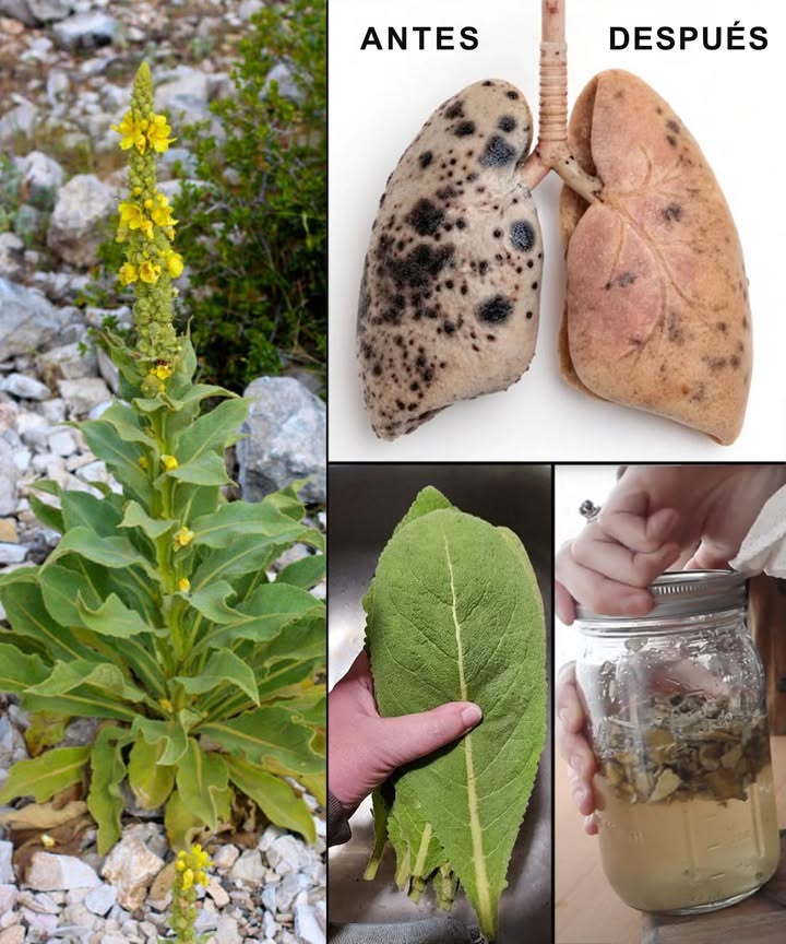 Gordolobo: explorando los beneficios de hojas, flores y raíces 

El gordolobo Verbascum thapsus es una planta medicinal ancestral con usos que abarcan desde el sistema respiratorio hasta el cuidado de la piel. Cada parte de la planta ofrece beneficios únicos que pueden aprovecharse en remedios caseros sencillos.

 Hojas de gordolobo

Apoyo respiratorio: calma la tos, asma y bronquitis

Expectorante: ayuda a expulsar mucosidad

Antiinflamatorio: reduce irritación en vías respiratorias y digestivas

Alivio de garganta irritada

Cicatrización de heridas y quemaduras

Analgésico: cataplasmas para dolor muscular y articular

Propiedades diuréticas y antibacterianas

 Flores de gordolobo

Infecciones de oído: el aceite de sus flores es un remedio clásico

Apoyo respiratorio: calma tos y asma

Sedante suave: alivia nervios y estrés

Antiinflamatorio y antimicrobiano

Favorece la cicatrización de heridas

Aceite para masajes que alivia dolor muscular y articular

Alivio de calambres menstruales

 Raíces de gordolobo

Salud articular: reduce dolor y rigidez

Alivio del dolor lumbar

Apoyo a la vejiga: fortalece y ayuda en casos de incontinencia

Antiinflamatorio y desintoxicante linfático

Diurético natural que favorece la función renal

 Formas de uso en casa

Infusiones de hojas para problemas respiratorios

Cataplasmas de hojas o raíces para dolores y heridas

Aceite de flores para dolor de oído o masajes

Infusión de flores para calmar nervios

Té de raíz para articulaciones y vejiga

El gordolobo es un tesoro herbal que apoya la salud integral de manera natural. Una planta versátil, suave pero poderosa, que conecta tradición y bienestar en cada preparación.