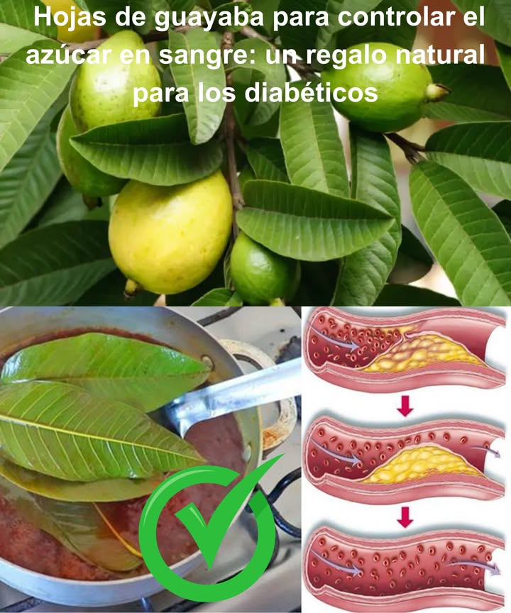 Hojas de guayaba para controlar el azúcar en sangre: un regalo natural para los diabéticos

Más allá de la fruta tropical, las hojas de guayaba son un tesoro terapéutico respaldado por la tradición y la ciencia moderna.

 Poder natural en cada hoja
 Ricas en quercetina, taninos y polifenoles
 Frenan la absorción de carbohidratos
 Mejoran la sensibilidad a la insulina
 Disminuyen los picos de azúcar después de comer
 Favorecen el buen funcionamiento del páncreas

 Cosecha y secado correctos
 Hora ideal: temprano en la mañana
 Escoge hojas verdes, firmes, jóvenes pero maduras
 Corta con tijeras limpias sin dañar la planta

 Secado natural
 Lava y seca con paño suave
 Extiende a la sombra en lugar ventilado
 Voltea a diario durante 710 días
 Guarda crujientes en frasco de vidrio hermético
 Conservan propiedades hasta 12 meses

 Formas de uso

 Té de hojas de guayaba
 57 hojas secas o frescas
 2 tazas de agua
Hierve, añade hojas, cocina 1012 min, cuela y bebe tibio antes de las comidas.
 Consejo: añade canela para potenciar sabor y beneficios.

 Polvo de hojas
 Tritura hojas secas
 Guarda en frasco hermético
 Toma  cucharadita en batidos, yogur o agua tibia con limón

 Remojo tradicional
 Deja hojas frescas en agua toda la noche
 Bebe en ayunas al día siguiente

 Precauciones
 Consulta al médico si estás embarazada, lactando o en tratamiento antidiabético
 No reemplaza medicación sin aprobación médica
 Empieza con dosis pequeñas y observa tu cuerpo

 Sencillas, económicas y efectivas: las hojas de guayaba son un aliado natural para equilibrar la glucosa día a día.