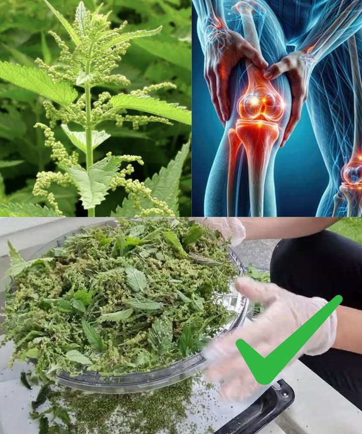El poder de la ortiga Urtica dioica: alivio natural para el dolor articular, la artritis y la inflamación A simple vista puede parecer una planta irritante, pero tras su picor se esconde un remedio ancestral con una fuerza terapéutica reconocida. La ortiga ha acompañado a la medicina tradicional durante siglos, y hoy la ciencia confirma su potencial para aliviar el dolor articular, reducir la inflamación y mejorar la movilidad. Propiedades antiinflamatorias naturales Rica en quercetina, ácido cafeico y clorogénico, la ortiga actúa como una cortisona natural que calma las citocinas inflamatorias. 𥳐 Té diario o cápsulas liofilizadas fortalecen su efecto. Alivio del dolor sin efectos secundarios Sus compuestos actúan sobre los receptores del dolor como los AINE, pero de forma segura. Aplicar hojas frescas con guantes o ungüento de ortiga sobre las zonas doloridas activa una respuesta antiinflamatoria inmediata. Desintoxicación y alivio de la presión articular La ortiga es un diurético suave que ayuda a eliminar ácido úrico y toxinas que agravan el dolor. 磻 Tomar 12 tazas de infusión al día, sola o con diente de león. Nutrición profunda para huesos y cartílagos Fuente natural de calcio, magnesio, sílice y boro, fortalece el esqueleto y mejora la movilidad. Añadir hojas cocidas a sopas o usar su polvo en batidos y comidas. Bloqueo natural de enzimas inflamatorias Sus extractos inhiben las enzimas COX-1 y COX-2, igual que los medicamentos para la artritis. Tomar extracto estandarizado 300500 mg al día durante los brotes. 溺 Equilibrio inmunitario en enfermedades autoinmunes La ortiga regula suavemente la respuesta inmunitaria, protegiendo las articulaciones sin suprimirlas. Combinar infusión interna y aplicación tópica para un efecto integral. Formas de uso Té: 12 cdtas. de hojas secas en agua caliente, 1015 min. Cápsulas o extractos: según indicación del envase. Golpecitos con hojas frescas con guantes sobre articulaciones. Aceite infusionado: ortiga seca en aceite de oliva 24 semanas. Polvo de ortiga: 1 cdta. al día en comidas o batidos. Una aliada para toda la vida La Urtica dioica no solo reduce el dolor, sino que revitaliza el cuerpo desde dentro. Usada con constancia, devuelve la flexibilidad, disminuye la rigidez y apoya una vida activa y libre de dolor. Consulta siempre a un profesional antes de usarla si tomas medicación o estás embarazada.