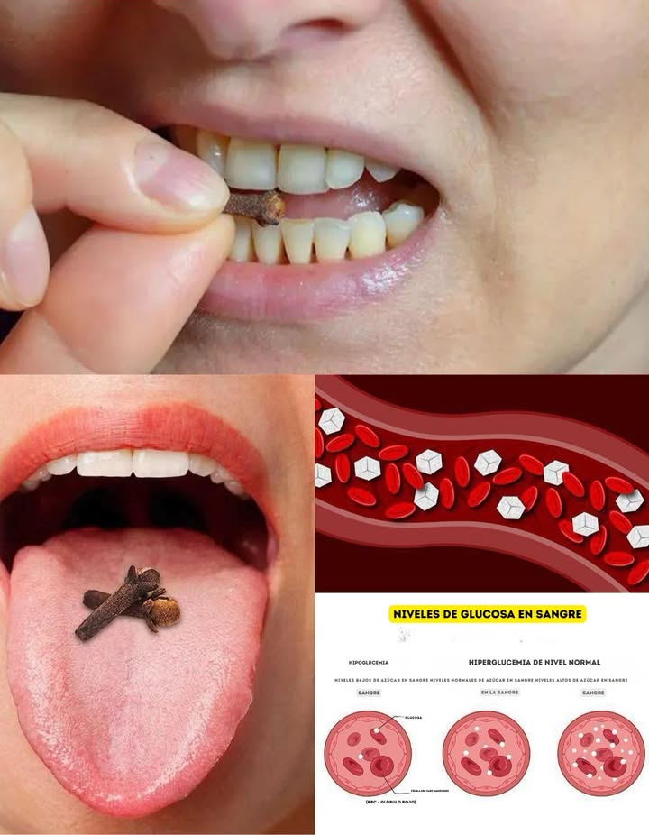 Masticar 2 clavos de olor al día podría salvarte la vida, aunque la mayoría de las personas no lo sabe 8 sorprendentes beneficios del agua de clavo de olor El clavo de olor es conocido por su aroma intenso y sus propiedades medicinales, pero al dejarlo en infusión en agua, sus beneficios se potencian. El agua de clavo de olor preparada dejando reposar 2 o 3 clavos durante una noche es rica en antioxidantes, compuestos antiinflamatorios y nutrientes esenciales que fortalecen la salud de forma natural. 1. Favorece la digestión Estimula la producción de enzimas digestivas y alivia el hinchazón, los gases y la indigestión. Beber un vaso por la mañana en ayunas ayuda a equilibrar el sistema digestivo. 醴 2. Mejora la salud bucal Gracias a sus propiedades antibacterianas, combate el mal aliento, calma las encías irritadas y ayuda a prevenir infecciones. También puede usarse como enjuague bucal natural. 3. Refuerza el sistema inmunológico Los antioxidantes presentes en el clavo protegen contra infecciones y reducen el estrés oxidativo, fortaleciendo las defensas del organismo. 4. Alivia los problemas respiratorios Su efecto expectorante y calmante ayuda en casos de tos, resfriado o garganta irritada. Beber el infuso tibio aporta alivio y despeja las vías respiratorias. 5. Mejora la salud de la piel Sus propiedades antibacterianas y antifúngicas ayudan a combatir el acné y las impurezas. Puede beberse o aplicarse diluida en el rostro para lograr una piel más limpia y purificada. 6. Regula la glucosa en sangre Los compuestos del clavo de olor favorecen la función de la insulina y ayudan a estabilizar los niveles de azúcar en la sangre. 例 7. Reduce dolores articulares e inflamaciones Gracias al eugenol, un potente antiinflamatorio natural, el agua de clavo de olor puede aliviar dolores y rigidez en las articulaciones, mejorando la movilidad. 8. Ayuda al control del peso Acelera el metabolismo y disminuye el apetito nervioso, generando una sensación de saciedad si se bebe antes de las comidas. Cómo prepararla Coloca 2 o 3 clavos de olor en un vaso de agua y déjalos en infusión durante toda la noche. Filtra y bebe al despertar, en ayunas. Para un efecto más concentrado, puedes hervir los clavos unos minutos, dejar enfriar y consumir el infuso. Un remedio sencillo, económico y natural El agua de clavo de olor apoya la digestión, fortalece las defensas y aporta energía al cuerpo cada día. #ClavosDeOlor #SaludNatural #BeneficiosDelClavo #AromaIntenso