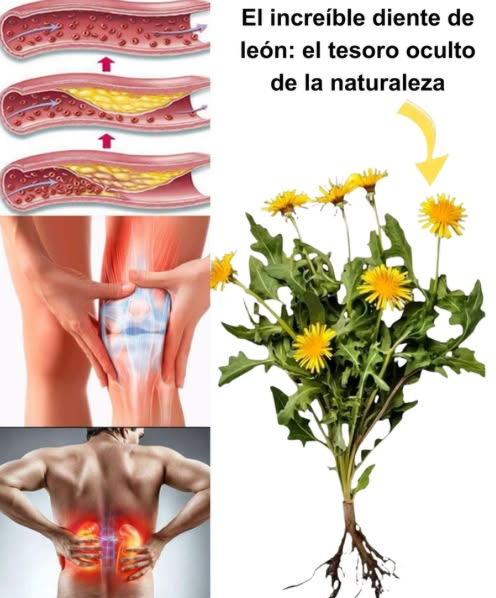 El increíble diente de león: el tesoro oculto de la naturaleza 
El diente de león Taraxacum officinale es más que una simple maleza. Desde su raíz hasta su flor, esta planta silvestre se considera un superalimento, con siglos de uso en la medicina tradicional. Sus propiedades depurativas, digestivas y nutritivas lo convierten en un aliado natural esencial.
 30 beneficios del diente de león
 Antioxidante natural  
 Fortalece las defensas  
 Mejora la digestión y reduce la hinchazón  
 Realiza una limpieza hepática profunda  
 Diurético suave y efectivo  
 Regula los niveles de azúcar en sangre  
 Apoya la salud renal  
 Facilita la pérdida de peso  
 Rico en vitaminas A, C y K  
 Beneficia la piel desde adentro  
 Fortalece los huesos  
 Previene infecciones urinarias  
 Tiene efecto antiinflamatorio  
 Combate la anemia  
 Equilibra las hormonas femeninas  
 Estimula el crecimiento del cabello  
 Protege la salud visual  
 Desintoxica la vesícula biliar  
 Aumenta la energía naturalmente  
 Mejora la salud cardiovascular  
 Disminuye el colesterol LDL  
 Potencial anticancerígeno  
 Retrasa el envejecimiento celular  
 Alivia eccema y psoriasis  
 Reduce el dolor articular  
 Fortalece dientes y encías  
 Mejora la memoria y concentración  
 Estimula el metabolismo  
 Combate bacterias  
 Previene cálculos biliares  
 Cómo usarlo en casa
 Hojas: en ensaladas, salteadas o en infusiones.  
 Flores: para tés, aceites o vinos medicinales.  
 Raíz: seca y tostada como café o en tinturas.  
 Precauciones
Evitar en caso de alergia a la ambrosía, si se utilizan anticoagulantes, diuréticos o se padece diabetes. Consulta a un especialista si hay problemas biliares. 
 Conclusión natural
Un regalo de la naturaleza que limpia, nutre y fortalece. Ya sea en una taza, un plato o en tu rutina de cuidado personal, el diente de león merece un lugar especial en tu vida.