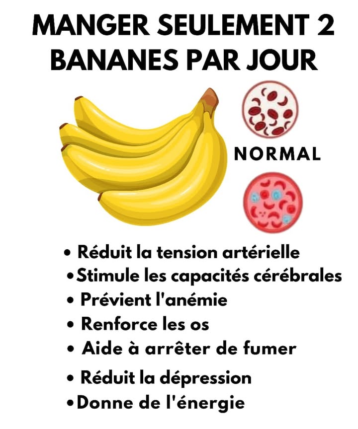 Mange 2 bananes par jour et transforme ta santé 
Les bananes ne sont pas seulement délicieuses, elles sont de véritables alliées du bien-être quotidien. En manger deux chaque jour peut tapporter plus de bénéfices que tu ne limagines 
1 Réduit la tension artérielle 喙
Grâce à leur richesse en potassium, elles aident à réguler la pression et à protéger ton cœur.
2 Stimule les capacités cérébrales 易
Leur teneur en magnésium et en vitamine B6 soutient la mémoire et la concentration.
3 Prévient lanémie 
Le fer contenu dans la banane favorise la production de globules rouges.
4 Renforce les os 領
Les minéraux quelle contient participent à la solidité et à la santé des os.
5 Aide à arrêter de fumer 
Les vitamines et minéraux quelle renferme aident le corps à se rétablir du manque de nicotine.
6 Réduit la dépression 
La banane stimule la production de sérotonine, lhormone du bonheur.
7 Donne de lénergie 
Un excellent encas avant ou après leffort pour recharger naturellement les batteries !
 Deux bananes par jour, un geste simple pour ton cœur, ton moral et ton énergie 
#santenaturelle  #energiepositive