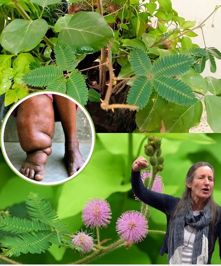 Les Bienfaits Cachés du Mimosa Pudica 
Inutile de chercher bien loin : cette plante timide, surnommée  sensitive  pour ses feuilles qui se referment au moindre toucher, cache des atouts surprenants pour le bien-être. Voici comment lintégrer doucement à ta routine.
 Ingrédients
 Feuilles séchées de Mimosa pudica
 Eau chaude
 Option : racines séchées
 Étapes simples
1 Fais chauffer de leau et ajoute une cuillère à café de feuilles ou de racines séchées.
2 Laisse infuser environ 10 minutes pour libérer les bienfaits.
3 Filtre et bois lentement, commence par une demi-tasse pour voir la réaction de ton corps.
4 Prends le temps de te détendre pendant ta dégustation, avec un souffle profond ou un moment calme.
5 Répète lexpérience quelques fois par semaine, toujours avec modération et en tenant compte de ton ressenti.
 Conseils pratiques
Le Mimosa pudica est reconnu pour apaiser le stress, soutenir la digestion et renforcer le système immunitaire.
En plus du thé, il peut être utilisé en petite quantité comme garniture dans certains plats traditionnels.
Vérifie toujours auprès dun professionnel de santé si tu prends déjà des médicaments ou si tu souffres de tension basse.
Cette plante nest pas un remède miracle, mais un doux allié naturel qui peut taccompagner vers plus de légèreté et de sérénité au quotidien.
#fblifestyle 
#mimosapudica  #plantesmedicinales