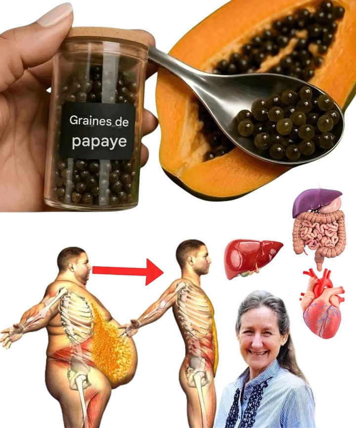 14 Bienfaits Surprenants des Graines de Papaye et Leurs Utilisations Naturelles 
Les graines de papaye sont souvent jetées, mais elles renferment de puissantes propriétés pour la santé. Riches en enzymes, antioxydants et acides gras essentiels, elles soutiennent le foie, améliorent la digestion et purifient lorganisme naturellement. Voici comment en tirer profit au quotidien.
籠 Ingrédients
1 cuillère à café de graines de papaye fraîches 省
1 verre deau tiède 
1 cuillère de miel facultatif 
1 Moudre les graines dans un mixeur ou les écraser avec une cuillère pour libérer leurs actifs.
2 Mélanger la poudre dans un verre deau tiède ou de jus naturel.
3 Boire le matin à jeun, 2 à 3 fois par semaine pour un effet détox.
4 Pour une digestion plus légère, mâcher directement 3 à 5 graines après un repas copieux.
5 En cure de soutien du foie, consommer pendant 7 jours consécutifs puis faire une pause.
 Bienfaits principaux
 Aident à éliminer les toxines du foie et des intestins
 Améliorent la digestion et réduisent les ballonnements
 Renforcent limmunité grâce à leurs antioxydants
 Contribuent à la perte de poids en stimulant le métabolisme
 Protègent le cœur et régulent le cholestérol
 Conseil : commencez toujours par de petites quantités, car les graines ont un goût amer et sont très puissantes.
 Un petit trésor naturel pour purifier le corps et retrouver énergie et légèreté. 
#remedesnaturels #bienetre