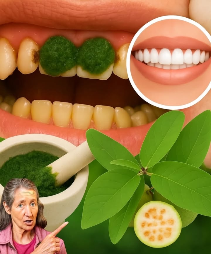Un sourire éclatant grâce aux feuilles de goyave : le secret naturel pour des dents plus saines