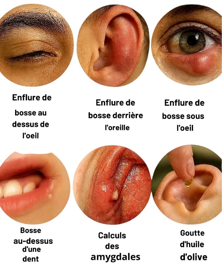 Conseils Santé : Comprendre les causes fréquentes 

 
#fblifestyle