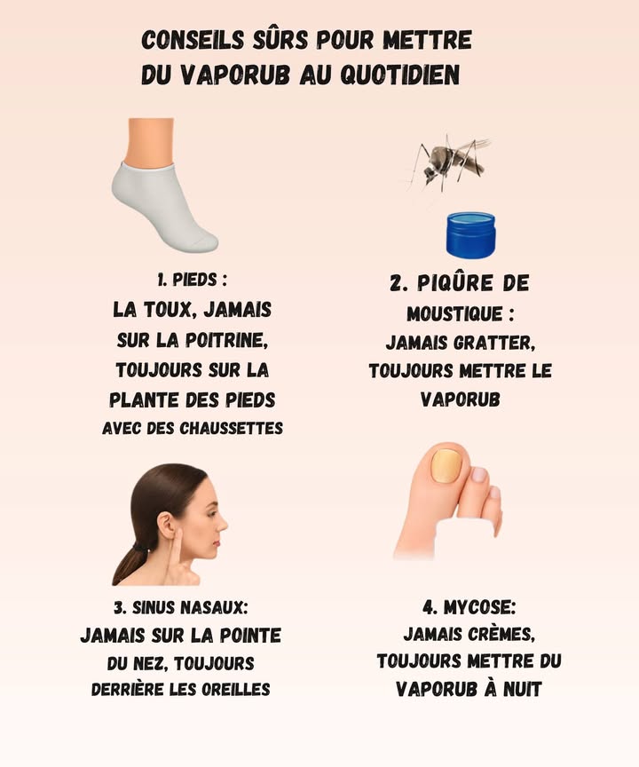 Astuces sûres pour utiliser le Vaporub au quotidien 1 Pieds : Pour la toux, oubliez la poitrine ! Mettez du Vaporub sur la plante des pieds et enfilez des chaussettes. Astuce : vous serez surpris par leffet relaxant pendant la nuit. 2 Piqûres de moustique : Jamais gratter ! Appliquez directement le Vaporub sur la piqûre. Cela soulage immédiatement et aide à réduire les démangeaisons. 3 Sinus nasaux : Ne mettez jamais sur la pointe du nez. Appliquez derrière les oreilles pour dégager les voies respiratoires. Astuce : ça fonctionne même en plein sommeil. 4 Mycose : Pas de crèmes chimiques ! Mettez du Vaporub sur la zone touchée la nuit. Vos pieds vous remercieront au réveil. Commentaire : je pensais que le Vaporub servait juste pour la poitrine mais en fait, cest un petit allié pour toute la maison !