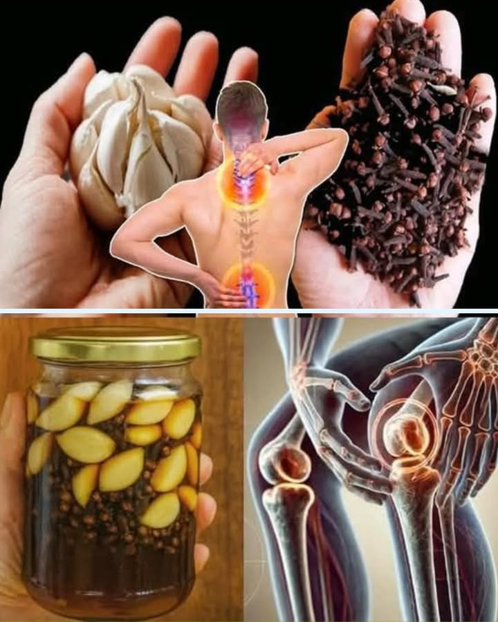 Remède maison ail & clou de girofle pour apaiser les douleurs 

1 Mélange ail  clous de girofle
Un duo simple qui sent fort parfois un peu trop fort si on en met partout comme moi la première fois !

2 Laisser infuser dans un bocal
Quelques jours de repos, et la préparation devient plus douce et plus efficace.

3 Masser les zones douloureuses
Nuque, dos, genoux une petite quantité suffit, pas besoin den vider le pot.

4 Utiliser régulièrement
La constance vaut mieux que trois couches dun coup. Oui, jai testé, et non ce nétait pas une bonne idée.

5 Tester dabord sur une petite zone
Histoire déviter de sentir lail pendant trois heures si votre peau réagit mal.