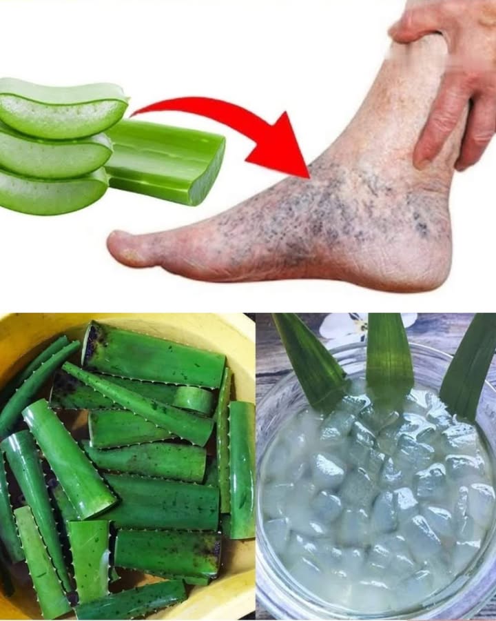 例 Aloe vera pour des jambes plus légères 例

1 Coupez quelques feuilles daloe vera bien fraîches. Astuce : choisissez celles du bas, elles sont plus riches en gel.

2 Lavez-les et retirez les bords épineux. Puis, ouvrez la feuille pour en extraire le gel translucide.

3 Appliquez directement ce gel sur la peau, en massant doucement les zones touchées varices, sécheresse, irritations. Sensation de fraîcheur immédiate ! 

4 Vous pouvez aussi mixer le gel avec un peu deau pour préparer un soin plus liquide et lutiliser en compresse.

Petit rappel : si ça pique ou brûle, stoppez immédiatement oui, même les plantes miracle ne conviennent pas à tout le monde .