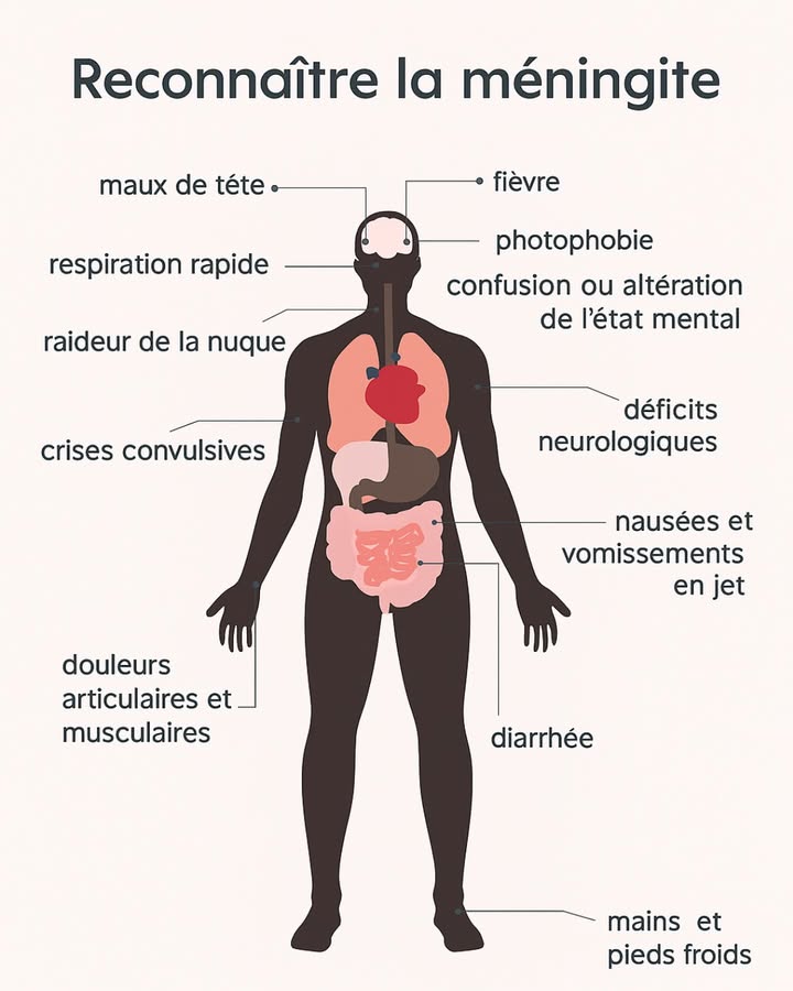 易 La méningite : une urgence à ne pas sous-estimer
Cette inflammation des méninges  les fines membranes qui protègent le cerveau et la moelle épinière  est souvent causée par une infection virale ou bactérienne 裂

 La forme bactérienne est la plus dangereuse : sans prise en charge rapide, elle peut entraîner des lésions neurologiques graves voire être fatale 

Découvrez les causes, symptômes et gestes essentiels à connaître pour réagir à temps