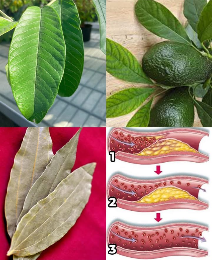 Le quattro foglie che eliminano il diabete, il cancro, i problemi di fegato grasso, la cattiva circolazione e la pressione alta senza pillole….
 Foglie che guariscono: i superpoteri nascosti delle piante 

 Foglie di Guava
 Regolano la glicemia inibendo lassorbimento dei carboidrati
 Abbassano il colesterolo LDL, proteggendo il cuore
 Azione anticancro con licopene e flavonoidi
什 Favoriscono la disintossicazione del fegato
 Migliorano la circolazione riducendo lo stress ossidativo

陋 Foglie di Avocado
 Riducono la pressione con la quercetina
溺 Proteggono il fegato e facilitano la detossificazione
喝 Migliorano la circolazione e prevengono i coaguli
療 Regolano la glicemia, ideali per il diabete
 Contengono polifenoli e flavonoidi anticancro

省 Foglie di Mango
離 Stimolano linsulina, utili contro il diabete
變 Rafforzano i vasi sanguigni e la circolazione
什 Proteggono il fegato dal grasso
 Rilassano i vasi, abbassando la pressione
 Contengono fenoli e antiossidanti contro il cancro

 Foglie di Fico
 Stabilizzano linsulina nel diabete tipo 2
 Proteggono il cuore riducendo trigliceridi
什 Detossificano il fegato naturalmente
喝 Regolano la pressione grazie al potassio
 Contrastano le cellule tumorali con bioattivi

 Foglie di Alloro
療 Aumentano la sensibilità allinsulina
什 Supportano il fegato e stimolano la bile
喝 Favoriscono il flusso sanguigno
 Rilassano i muscoli cardiaci, abbassando la pressione
 Linalolo ed eugenolo contro il cancro

 Un infuso, una foglia, un grande alleato per la salute naturale