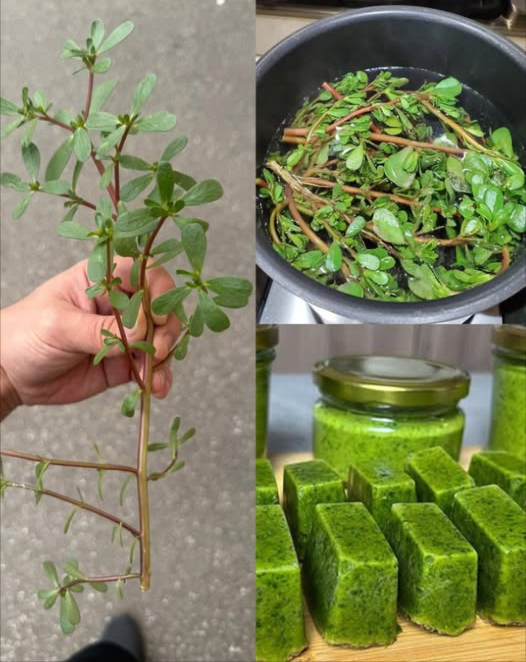 Portulaca ogni giorno: il superfood che nutre, protegge e rigenera 
Non è solo unerbaccia! Il purslane è un superfood naturale ricchissimo di benefici per corpo, mente e bellezza 

 1. Salute del cuore
Ricco di omega-3 vegetali: riduce infiammazioni e protegge dai disturbi cardiovascolari

 2. Pelle giovane e luminosa
Vitamine A e C stimolano la rigenerazione e combattono le rughe

 3. Anti-infiammatorio e antiossidante
Neutralizza i radicali liberi, utile contro malattie croniche

 4. Protegge la vista
Il beta-carotene previene la degenerazione maculare

 5. Aiuta nella perdita di peso
Pochissime calorie, tante fibre: sazia, idrata e dà energia

 6. Rinforza le ossa
Con calcio, magnesio e potassio per una struttura ossea forte

 7. Digestione felice
Fibra prebiotica che nutre la flora intestinale e regola il transito

 8. Glucosio sotto controllo
Ottimo per chi ha il diabete: migliora la risposta insulinica

 9. Immunità potenziata
Vitamine e zinco per rafforzare le difese naturali

 10. Idrata e riequilibra
Acqua  elettroliti = perfetto per prevenire disidratazione

易 11. Cervello attivo e protetto
Gli omega-3 supportano memoria e concentrazione

綾 Come usarlo in cucina:
 Crudo nelle insalate
 Saltato con aglio e olio doliva
 In smoothie verdi
 Nelle zuppe o stufati

 Un dono spontaneo della natura, semplice da trovare, ricco di salute. Aggiungilo alla tua dieta e scopri il potere del purslane! 塞