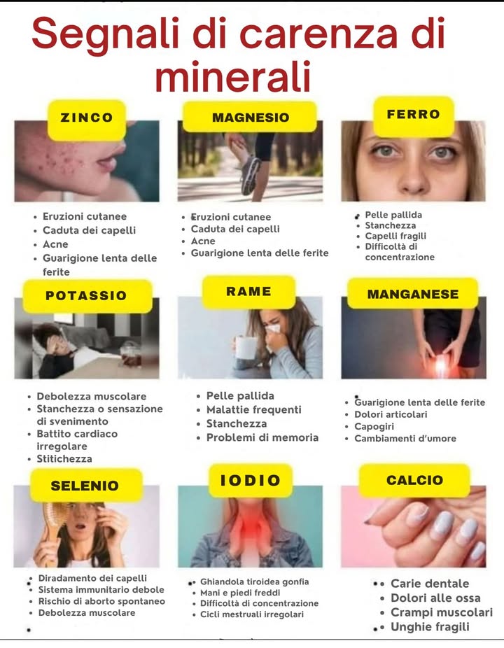 Segnali di carenza di minerali nel corpo

Ogni minerale svolge un ruolo fondamentale nel mantenere lequilibrio dellorganismo. La loro carenza può manifestarsi con sintomi visibili che non vanno ignorati.

Zinco: eruzioni cutanee, caduta dei capelli, acne, guarigione lenta delle ferite.

Magnesio: crampi muscolari, stanchezza, irritabilità, insonnia.

Ferro: pelle pallida, stanchezza, capelli fragili, difficoltà di concentrazione.

Potassio: debolezza muscolare, battito cardiaco irregolare, stitichezza, sensazione di svenimento.

Rame: pelle pallida, infezioni frequenti, stanchezza, problemi di memoria.

Manganese: dolori articolari, capogiri, cambiamenti dumore, guarigione lenta.

Selenio: diradamento dei capelli, sistema immunitario debole, debolezza muscolare.

Iodio: ghiandola tiroidea gonfia, mani e piedi freddi, cicli mestruali irregolari.

Calcio: carie dentale, dolori alle ossa, crampi muscolari, unghie fragili.

喝 Unalimentazione varia e bilanciata è la chiave per prevenire squilibri e mantenere il corpo in salute.