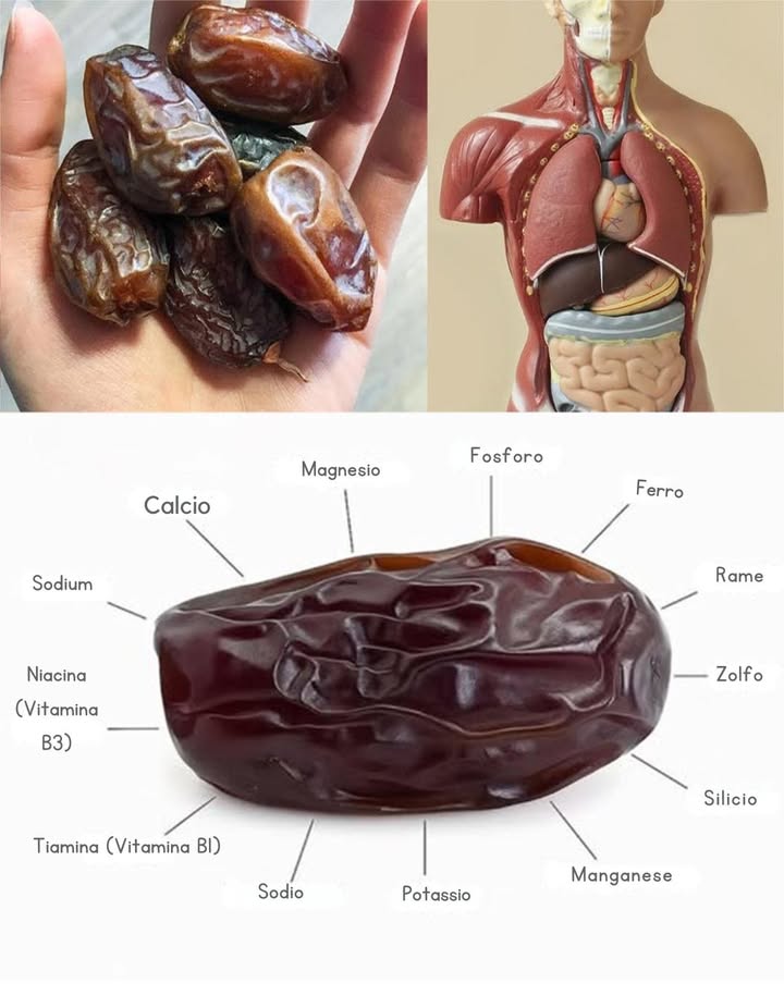 IL FRUTTO PIÙ SALUTARE sulla Terra: una persona può vivere solo di datteri e acqua mio nonno ha vissuto più di 100 anni mangiando 7 datteri al giorno.
 Datteri  Un Superfood Ricco di Nutrienti
Frutti dolci e antichissimi, originari di Medio Oriente e Nord Africa. Freschi o secchi, offrono energia, fibre e un mix unico di vitamine e minerali.

 Profilo Nutrizionale Potente
 Magnesio  Potassio  Calcio  Manganese  Ferro  Fosforo  Vitamina A
 Ricchi di fibre per la digestione
 Bassi in grassi, moderati in proteine
 Antiossidanti flavonoidi, carotenoidi, acido fenolico contro infiammazione e stress ossidativo

 Energia Naturale
Perfetti per sportivi e stili di vita attivi
Zuccheri naturali che rilasciano energia graduale senza picchi
Snack ideale pre o post allenamento

 Digestione & Intestino
Fibre che prevengono stitichezza
Sostengono i batteri benefici intestinali
Riduzione del rischio di IBS e disturbi gastrointestinali

易 Cervello & Memoria
Antiossidanti che riducono linfiammazione cerebrale
Migliorano memoria e funzioni cognitive
Protezione contro malattie neurodegenerative

領 Ossa Forti & Ferro Anti-Anemia
Calcio e ferro per densità ossea e prevenzione osteoporosi
Ferro per aumentare emoglobina ed energia
Riduzione di stanchezza e capogiri

 Cuore & Pressione
Senza colesterolo, poveri di grassi
Abbassano LDL colesterolo cattivo
Potassio e magnesio che regolano la pressione sanguigna

 Peso & Sazietà
35 datteri al giorno per calmare la fame di zuccheri
Fibre e nutrienti che danno senso di pienezza
Perfetti per spuntini sani, ma con moderazione

綾 Come Usarli
Snack al naturale
Aggiunti a frullati, insalate, porridge o dolci
Abbinati a frutta secca e semi per mix energetici

 Datteri  Un Must nella Dieta
Un superfood versatile che sostiene digestione, cervello, ossa e cuore. Dolcezza naturale, energia stabile e nutrienti preziosi per il benessere quotidiano.