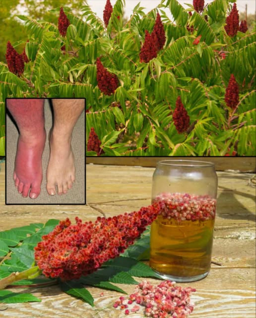 Dimenticate la farmacia: questo albero potrebbe sostituire metà del vostro armadietto dei medicinali.
 Sommacco Sumac: la spezia rossa che nutre e protegge 

 Benefici naturali del sommacco
 Antinfiammatorio potente
Allevia artrite, dolori articolari e infiammazioni croniche.

 Amico del cuore
Abbassa il colesterolo e migliora la salute dei vasi sanguigni.

 Difese più forti
Ricco di vitamina C, combatte virus e raffreddori.

 Digestione serena
Stimola gli enzimi digestivi, riduce gonfiore e acidità.

喝 Controlla la glicemia
Aiuta a regolare i livelli di zucchero nel sangue.

裂 Antibatterico e antifungino
Contrasta infezioni e rafforza lorganismo.

 Sostiene il controllo del peso
Riduce la fame nervosa e stimola il metabolismo.

 Calma la gola irritata
Tisana utile per tosse, mal di gola e bronchite.

 Effetto anti-age
Antiossidanti contro acne, rughe e segni del tempo.

溺 Previene i tumori
Protegge le cellule dallo stress ossidativo.

 Respiro più libero
Aiuta in caso di tosse secca o bronchite.

 Più energia
Contrasta stanchezza e migliora la vitalità.

領 Ossa più forti
Fonte naturale di calcio e minerali essenziali.

 Salute urinaria
Azione antibatterica contro infezioni urinarie.

 Detox naturale
Aiuta il fegato a eliminare tossine in eccesso.

 Come usarlo in casa
綾 Spezia aromatica  Su insalate, carne, verdure, riso
 Tisana: 1 cucchiaino in acqua calda, infondere 510 min
 Acqua detox: Aggiunto a infusi o acqua aromatizzata
林 Maschera viso: Pasta per acne o pelle irritata
北 In yogurt e salse: Per un gusto fresco e digestivo

 Usalo con moderazione se sei in gravidanza o prendi farmaci. Consulta un professionista per un uso prolungato.

 Il sommacco è molto più di una spezia: è un vero elisir rosso per la tua salute quotidiana!