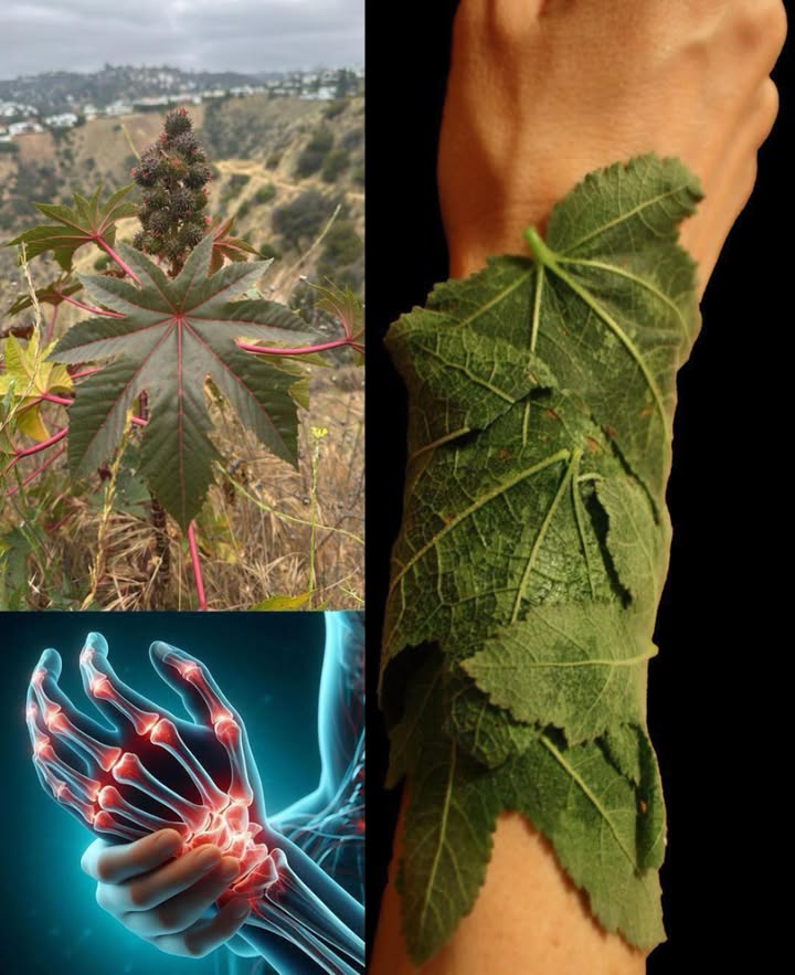 Forse conosci questa pianta, ma non hai mai saputo il potere delle sue foglie 
10 Potenti Benefici delle Foglie di Ricino che Probabilmente non Conoscevi

Quando si parla di ricino Ricinus communis, tutti pensano allolio, ma le foglie sono un tesoro nascosto della medicina naturale. Ricche di proprietà antinfiammatorie, antibatteriche e depurative, sono utilizzate da secoli in molte culture per favorire la guarigione e il benessere generale.

 Scopri i 10 straordinari benefici delle foglie di ricino e come usarle in modo naturale:

1 Alleviano dolori articolari e muscolari
Grazie al loro potere antinfiammatorio, le foglie calde di ricino riducono il dolore da artrite o tensioni muscolari.
 Scalda leggermente la foglia, applicala sulla zona e copri con un panno.

2 Purificano e disintossicano lorganismo
Impacchi di foglie di ricino aiutano il drenaggio linfatico e sostengono fegato e digestione nel processo di disintossicazione naturale.

3 Favoriscono la cicatrizzazione
Antibatteriche e antifungine, le foglie di ricino aiutano a guarire piccole ferite e irritazioni cutanee.
 Applica foglie fresche schiacciate o un impacco pulito.

4 Riducono i dolori mestruali
Un impacco caldo sulladdome rilassa i muscoli e allevia i crampi mestruali in modo naturale.

5 Rinforzano i capelli e il cuoio capelluto
Un risciacquo con decotto di foglie di ricino stimola la crescita e riduce la forfora.
 Fai bollire le foglie, filtra e usa lacqua come ultimo risciacquo.

6 Sostengono lallattamento
Tradizionalmente, le foglie di ricino vengono usate per stimolare il flusso di latte e alleviare la tensione al seno.

7 Calmano gonfiori e infiammazioni
Applicate localmente, riducono punture di insetti, distorsioni o arrossamenti.

8 Aiutano la respirazione
Il vapore di foglie bollite libera i bronchi e attenua tosse e congestione.

9 Combattono problemi della pelle
Grazie alle loro proprietà antimicrobiche, migliorano acne, eczema e micosi.

 Favoriscono la digestione
Infusi leggeri di foglie di ricino stimolano la digestione e alleviano il gonfiore.

 Nota di sicurezza:
Non ingerire foglie crude. Il ricino contiene ricina, una sostanza tossica presente soprattutto nei semi. Usa solo in modo esterno o con conoscenze adeguate.

 In sintesi:
Le foglie di ricino sono un rimedio naturale potente e versatile: leniscono il dolore, rigenerano la pelle, stimolano la circolazione e favoriscono lequilibrio interno. Un piccolo segreto della natura per il tuo benessere quotidiano.