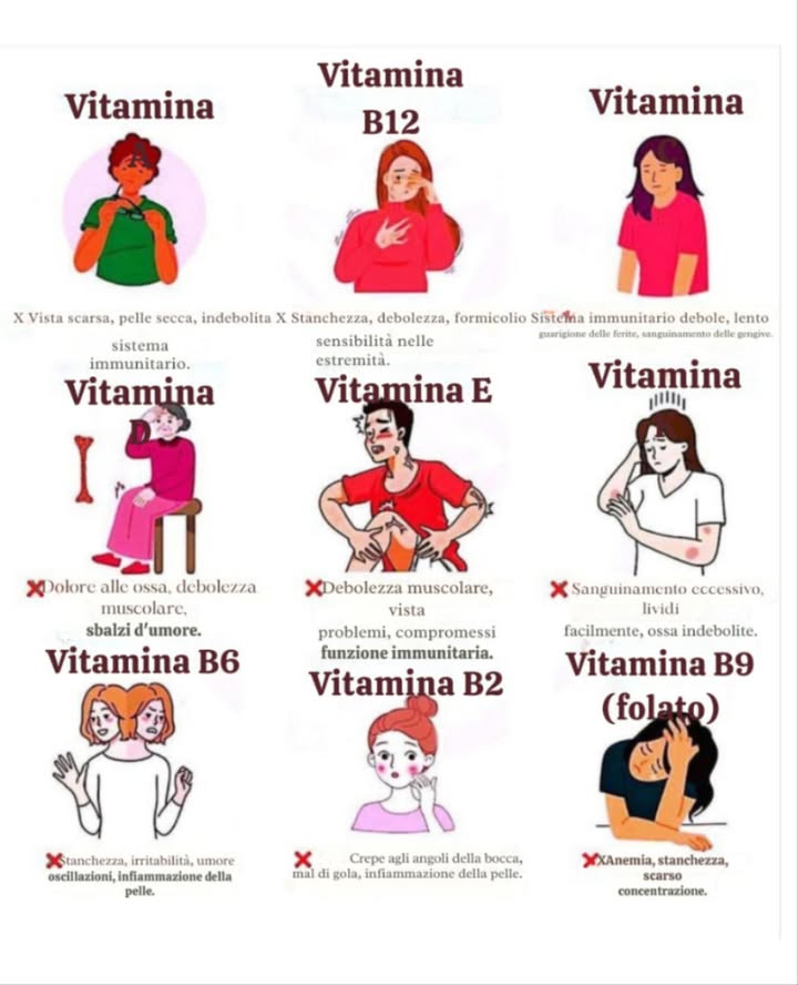 Segnali che il Tuo Corpo Ti Sta Chiedendo Vitamine Essenziali 
Pinterest-style in italiano 
凌 Vitamina A
 Segnali:
 Vista notturna scarsa
 Pelle secca e squamosa
 Ti ammali spesso
 Importanza: Vista, pelle e sistema immunitario forti.
 Vitamina B12
 Segnali:
 Stanchezza cronica
 Formicolio mani/piedi
 Confusione mentale, sbalzi dumore
 Importanza: Nervo sano e produzione di globuli rossi.
 Vitamina C
 Segnali:
 Raffreddori frequenti
 Ferite che guariscono lentamente
 Gengive sanguinanti
 Importanza: Immunità forte e pelle sana grazie al collagene.
 Vitamina D
 Segnali:
 Dolori ossei
 Debolezza muscolare
 Umore basso o depressione
 Importanza: Assorbimento del calcio e benessere mentale.
樂 Vitamina E
 Segnali:
 Debolezza muscolare
 Visione offuscata
 Sistema immunitario debole
 Importanza: Antiossidante che protegge le cellule.
塞 Vitamina K
 Segnali:
 Lividi facili
 Sanguinamenti prolungati
 Ossa fragili
 Importanza: Coagulazione del sangue e salute ossea.
易 Vitamina B6
 Segnali:
 Stanchezza
 Irritabilità o sbalzi dumore
 Problemi della pelle
 Importanza: Cervello attivo e difese forti.
 Vitamina B2 Riboflavina
 Segnali:
 Angoli della bocca screpolati
 Mal di gola
 Infiammazioni cutanee
 Importanza: Energia e salute di occhi e pelle.
溺 Vitamina B9 Folati
 Segnali:
 Anemia
 Stanchezza continua
 Difficoltà di concentrazione
 Importanza: Produzione cellulare e benessere mentale.
 Ascolta il tuo corpoogni sintomo è un messaggio!