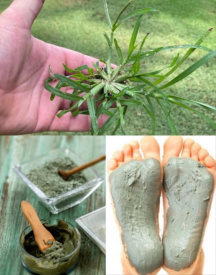 La maggior parte delle persone ha questa pianta nel proprio giardino, ma non sa che si tratta di unerba potente, non di unerbaccia…
 Eleusine indica: la pianta sotto i piedi che purifica, rinfresca e rilassa 禮

Usata da secoli nelle tradizioni popolari, questa erba umile è un vero toccasana per corpo e mente partendo dai piedi!

 1. Detossificazione naturale
Elimina tossine e impurità attraverso i piedi, lasciandoti più leggero e pulito 

 2. Riduce la febbre
Ha un effetto rinfrescante che aiuta ad abbassare il calore corporeo

 3. Antinfiammatoria potente
Calma gonfiori, dolori e infiammazioni a piedi e caviglie

喝 4. Stimola la circolazione
Favorisce il flusso sanguigno e lequilibrio energetico

 5. Rilassa corpo e mente
Un impacco ai piedi = effetto spa casalingo antistress

禮 6. Lenisce piedi stanchi
Ottima dopo lunghe camminate o giornate in piedi

 7. Idratazione profonda
Ammorbidisce talloni secchi grazie alla sua pasta ricca di umidità vegetale

 8. Drena il sistema linfatico
Aiuta il corpo a eliminare i rifiuti e a sgonfiarsi

 9. Rinforza il sistema immunitario
Ricca di antiossidanti che sostengono la difesa naturale del corpo

 10. Cura la pelle
Ideale per irritazioni cutanee lievi grazie alleffetto lenitivo

 Un pediluvio, un impacco o una semplice pasta fresca e lEleusine indica trasforma il tuo momento di riposo in un rituale curativo naturale