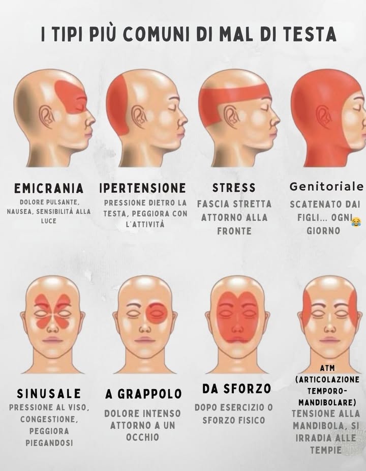 Tipi più Comuni di Mal di Testa & Dove Colpiscono 
 Emicrania
 Dove: Un lato della testa, dietro locchio o alla tempia
 Sensazione: Dolore pulsante, intenso
 Altri segni: Nausea, sensibilità a luce e suoni
 Cefalea da Ipertensione
 Dove: Parte posteriore della testa
 Sensazione: Dolore sordo e pulsante
 Nota: Peggiora al mattino, legata a pressione alta
 Cefalea da Tensione Stress
 Dove: Fronte, tempie, o come una fascia attorno alla testa
 Sensazione: Pressione costante, senso di oppressione
 Nota: Spesso detta mal di testa a fascia
 Cefalea da Affaticamento Parentale
 Dove: Tutta la testa
 Sensazione: Dolore sordo da stanchezza
 Causa: Stress, mancanza di sonno, sovraccarico mentale
 Cefalea Sinusale
 Dove: Fronte, occhi, guance
 Sensazione: Pressione e sensibilità
 Altri segni: Congestione nasale, febbre
 Cefalea a Grappolo Cluster
 Dove: Dietro un occhio o su un lato del capo
 Sensazione: Dolore fortissimo, trafittivo
 Altri segni: Lacrimazione, naso chiuso, palpebra che cala
 Cefalea da Sforzo
 Dove: Tutta la testa
 Sensazione: Dolore improvviso o pressione dopo attività fisica
 Trigger: Esercizio, tosse, sollevamento pesi
 Cefalea da ATM Articolazione Temporo-Mandibolare
 Dove: Tempie, mascella, orecchie, collo
 Sensazione: Dolore diffuso, mascella che scrocchia o rigidità
 Causa: Tensione muscolare e articolare della mandibola
 Quando Consultare un Medico
 Mal di testa improvviso e molto forte
 Associato a disturbi visivi o intorpidimento
 Persistente o che peggiora col tempo