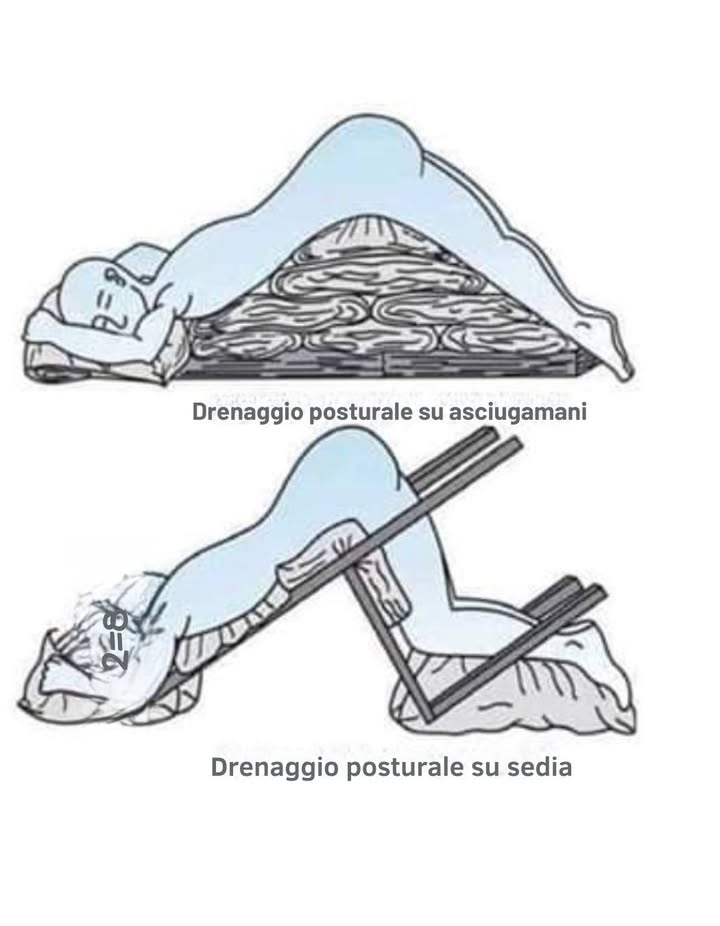 Nel 1976, unepidemia di influenza letale colpì le case di riposo in Vietnam.
Le risorse erano scarse: niente antivirali, bombole dossigeno o ventilatori. Solo asciugamani e umanità.

In una di queste strutture, gli operatori fecero qualcosa di straordinario.
Usando solo la conoscenza del corpo e la gravità, improvvisarono una tecnica semplice nota come drenaggio posturale: posizionavano i pazienti su letti inclinati o con asciugamani arrotolati sotto laddome, favorendo il drenaggio dei liquidi dai polmoni e mantenendo le vie respiratorie libere.

Il risultato? Nessuna vita perduta.
Mentre le altre case contavano decine di morti, quella rimase un piccolo miracolo silenzioso.

Quasi nessuno fuori dal Vietnam conobbe questa storia.
Ma resta un potente promemoria:
冀 A volte non sono le macchine a salvare le vite, ma lingegno, lattenzione e la cura.