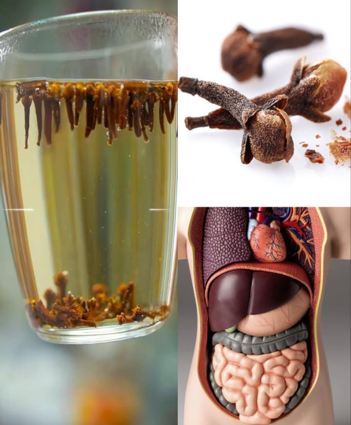Acqua di chiodi di garofano: un piccolo sorso dal grande potere. Una bevanda semplice con una forza sorprendente che la maggior parte delle persone sottovaluta…
 Acqua di Chiodi di Garofano: 30 Benefici Naturali
 Benefici principali
 Digestione leggera, meno gonfiore
醴 Sollievo mal di denti
 Alito fresco e gengive sane
 Difese immunitarie forti
 Riduce infiammazioni e dolori articolari
喝 Supporta glicemia equilibrata
 Libera respiro e calma tosse
濫 Contro nausea e stomaco irritato
 Pelle più sana, meno acne
 Aiuta nel controllo del peso
 Calma crampi mestruali
 Migliora circolazione e cuore
洛 Lenisce mal di testa e mal di gola
 Capelli più forti e senza forfora
領 Rinforza ossa e metabolismo
籠 Come prepararla
1 Far bollire 1 tazza dacqua 250 ml
2 Aggiungere 1015 chiodi di garofano
3 Sobbollire 57 minuti
4 Coprire e infondere 10 min
5 Filtrare  si conserva in frigo fino a 2 giorni
 Modi duso
  tazza a digiuno come tonico
 Risciacquo capelli o bagno pelle
醴 Collutorio naturale contro batteri orali
 Gargarismi per mal di gola
 Tamponare acne fare patch test
 1 tazza calda durante il ciclo
蠟 23 tazze al giorno in caso di raffreddore
 Nota: evitare eccessi. Chiedere consiglio medico in gravidanza, con ulcere o se si assumono fluidificanti del sangue.