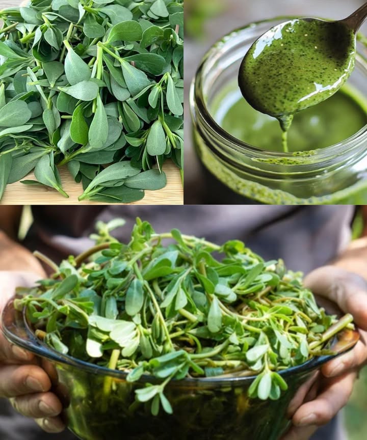 Verdolaga: el superalimento olvidado con poderes extraordinarios para tu salud

Entre las plantas más humildes de la naturaleza se esconde un tesoro nutricional que muchos confunden con una simple maleza. La verdolaga, con su aspecto discreto, es en realidad una fuente inagotable de energía vital, cargada de vitaminas, minerales y compuestos bioactivos que fortalecen cuerpo y mente. Lo que muchos arrancan de sus jardines podría ser, en realidad, un elixir de salud y bienestar.

 Beneficios sorprendentes de la verdolaga
 Rica en omega-3: protege el corazón, mejora la circulación y favorece el cerebro.
 Antioxidante natural: gracias a las vitaminas A, C y E, combate el envejecimiento y fortalece el sistema inmunitario.
 Antiinflamatoria potente: alivia dolencias articulares y previene enfermedades crónicas.
 Amiga de la piel: regenera, cicatriza y aporta luminosidad.
 Fuente de minerales: calcio, magnesio, potasio e hierro para huesos y músculos fuertes.
 Refuerza las defensas: su alto contenido en vitamina C ayuda a prevenir resfriados.
 Visión y piel saludables: su betacaroteno estimula la producción de vitamina A.
 Mejor descanso: la melatonina natural mejora la calidad del sueño.
 Reduce el colesterol: sus betalaínas limpian las arterias y protegen el corazón.
 Equilibra el ánimo: el triptófano promueve la serotonina, la hormona de la felicidad.

 Cómo aprovecharla al máximo
 Añade hojas frescas a ensaladas o batidos para conservar sus nutrientes.
 Saltea con ajo y aceite de oliva como guarnición ligera.
 Incorpórala a sopas y guisos para darles cuerpo y valor nutricional.
 Sustituye la albahaca del pesto por verdolaga para una versión más saludable.
 Encurtida, ofrece un toque ácido y refrescante para acompañar cualquier plato.

 Truco extra
Usa una infusión de verdolaga como tónico facial natural: revitaliza, calma e hidrata la piel.

 A veces los mayores regalos de la naturaleza crecen en silencio bajo nuestros pies. La verdolaga, lejos de ser una simple hierba, es un auténtico héroe nutricional, capaz de transformar tu dieta y elevar tu bienestar día a día.