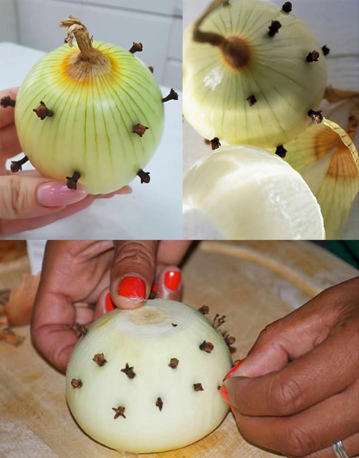 Mia nonna francese infila sempre dei chiodi di garofano in una cipolla.  Quando ho scoperto perché lo faceva, sono rimasta sorpresa, perché non lavevo mai visto prima.  Ora lo faccio anchio e sono assolutamente entusiasta di questo trucchetto. Lasciate che vi spieghi a cosa servono i chiodi di garofano in una cipolla. 
龍 Chiodi di Garofano e Cipolla: il rimedio antico dal potere moderno 

Da secoli, chiodi di garofano e cipolla vengono usati insieme nella medicina tradizionale per le loro straordinarie proprietà curative.
Uniscono aroma, forza e nutrimento, creando una sinergia naturale che sostiene corpo e mente in modo sorprendente.

 Benefici principali di chiodi di garofano e cipolla
 Rinforzano il sistema immunitario grazie agli antiossidanti e ai composti antimicrobici 
 Sostengono la salute respiratoria, alleviando tosse, muco e mal di gola 
 Migliorano la digestione, riducendo gonfiore e favorendo la flora intestinale
 Aiutano a regolare la glicemia, migliorando la sensibilità allinsulina 
 Proteggono cuore e circolazione, riducendo colesterolo e pressione alta 
 Agiscono come antinfiammatori e analgesici naturali per dolori muscolari o articolari
 Favoriscono la depurazione di fegato e reni eliminando tossine
 Combattono alitosi e infezioni orali grazie allazione antibatterica 醴
 Migliorano la pelle, contrastando acne e imperfezioni 
 Stimolano la crescita dei capelli e prevengono la forfora grazie al contenuto di zolfo 暈

 Come usare chiodi di garofano e cipolla

1 Tisana depurativa e rinforzante
 34 chiodi di garofano  1 cipolla piccola tagliata  1 tazza dacqua
 Fai bollire per 10 min, filtra e bevi tiepida con un cucchiaino di miele 

2 Acqua infusa per limmunità
 Metti qualche chiodo di garofano dentro una cipolla e lasciala in acqua tutta la notte
 Bevi al mattino per stimolare energia e difese naturali

3 Impacco per dolori
 Prepara una pasta con chiodi di garofano tritati e succo di cipolla
 Applica su articolazioni o muscoli doloranti per 1520 minuti

4 Gargarismi per la salute orale
 Fai bollire chiodi di garofano e cipolla in acqua
 Usa il decotto tiepido come collutorio naturale 醴

5 Maschera per capelli
 Mescola succo di cipolla con poche gocce di olio di chiodi di garofano
 Applica sul cuoio capelluto, lascia agire 30 minuti e risciacqua 类

 Un rimedio antico, una forza attuale
Questo duo potente unisce tradizione e scienza moderna: protegge, purifica e rigenera.
Un gesto semplice come una tisana o un impacco può diventare un rituale naturale di benessere.

 Avvertenze
 Usa con moderazione: leccesso può irritare lo stomaco.
 Evita in gravidanza o durante terapie farmacologiche senza consiglio medico.

 Cipolla e chiodi di garofano: due ingredienti umili, due alleati straordinari per salute, bellezza e vitalità quotidiana.