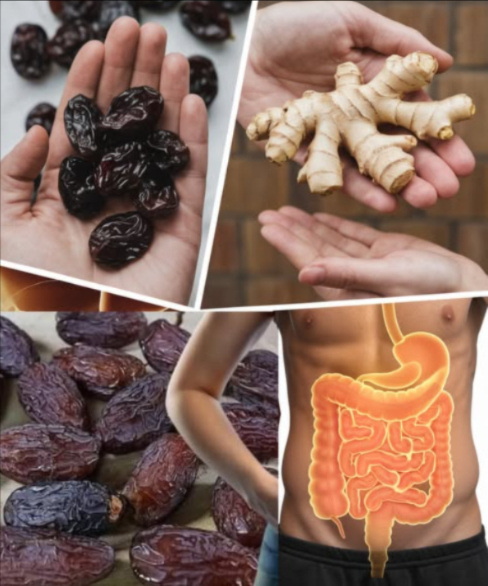 La muerte empieza en los intestinos. Gases estomacales.
Hígado graso.
Limpieza intestinal. Medicina natural.
Sólo los miembros educados dan las gracias.
Método en el primer comentario
La combinación de dátiles y jengibre no solo ofrece un sabor delicioso, sino también poderosos beneficios  medicinales. Conocidos por sus propiedades curativas, estos ingredientes han sido utilizados durante siglos para tratar una variedad de problemas de salud, incluyendo problemas intestinales, gases estomacales e hígado graso. En este artículo, exploraremos cómo preparar dos recetas efectivas con dátiles y jengibre, así como sus beneficios, propiedades, precauciones y modos de consumo. Acompáñanos a descubrir los secretos de esta  hierba sagrada y medicinal de África!
Receta 1: Infusión de dátiles y jengibre
Ingredientes:
5 dátiles deshuesados
1 trozo de jengibre fresco 3 cm
2 tazas de agua
1 cucharadita de miel opcional
Preparación:
Lava los dátiles y el jengibre con agua tibia para eliminar cualquier residuo.
Corta el jengibre en rodajas finas y agrégalo a una olla con 2 tazas de agua.
Lleva el agua a ebullición y cocina a fuego lento durante 10 minutos.
Agrega los dátiles deshuesados y cocina por 5 minutos más.
Cuela la infusión y endúlzala con miel si lo deseas.
Sirve caliente y disfruta.
Modo de consumo: Se recomienda consumir esta infusión dos veces al día, una por la mañana en ayunas y otra antes de dormir. Idealmente, durante un periodo de 15 días para obtener resultados óptimos.
Beneficios:
Alivia los gases estomacales al reducir la inflamación del tracto digestivo.
Mejora la digestión al estimular la producción de enzimas.
Desintoxica el hígado gracias a los antioxidantes presentes en el jengibre y los dátiles.
Reduce la acidez estomacal.
Promueve el equilibrio de la flora intestinal.
Combate el estreñimiento.
Mejora la circulación sanguínea.
Refuerza el sistema inmunológico.
Disminuye la sensación de pesadez después de las comidas.
Previene cólicos estomacales.
Protege las paredes del estómago.
Reduce el colesterol.
Alivia los síntomas del síndrome del intestino irritable.
Favorece la eliminación de toxinas.
Regula los niveles de glucosa en sangre.
Promueve la relajación muscular.
Combate los radicales libres.
Mejora la absorción de nutrientes.
Actúa como antiinflamatorio natural.
Protege contra infecciones bacterianas.
Alivia los mareos asociados a problemas digestivos.
Mejora la energía y vitalidad.
Reduce el riesgo de úlceras estomacales.
Mejora la calidad del sueño.
Favorece la pérdida de peso en programas de desintoxicación.