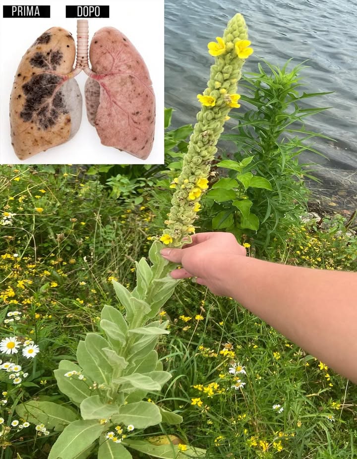 Questa pianta ha più potere di quanto si pensi e cresce ovunque …
Da secoli usato come rimedio tradizionale, il verbasco è una pianta spontanea che cresce lungo strade e campi aperti, famosa per alleviare tosse, bronchite, asma e congestione polmonare.

 Disturbi Respiratori che il Verbasco Può Alleviare

 Tosse secca o grassa
 Bronchite e asma
 Congestione polmonare
 Mal di gola e laringite
 Infezioni dei seni nasali 蠟
 Tosse da fumo 
 Debolezza post-COVID
 BPCO e enfisema sollievo sintomatico
 Respiro sibilante e oppressione toracica

 Azione doppia: scioglie il muco  lenisce i tessuti infiammati

 Come Riconoscere il Verbasco

 1 anno: rosetta di foglie grandi, soffici e vellutate
 2 anno: fusto floreale alto fino a 2 m con fiori gialli 
 Foglie grigio-verdi, spesse e pelose da qui foglia di flanella
 Cresce in zone assolate e asciutte

 Raccolta e Conservazione

 Foglie: primavera  inizio autunno 1 anno
 Fiori: estate, durante la fioritura
 Essiccazione: allombra, in strato singolo, conservare in barattolo ermetico al buio

 Raccogli solo in luoghi puliti, lontani da strade e pesticidi

 Come Usarlo per la Salute dei Polmoni

1 Tisana: 1 cucchiaio foglie/fiori secchi in acqua bollente, 1015 min. Filtra bene. Fino a 3 tazze/dì.
2 Fumenti: foglie in acqua bollente  inalare il vapore 510 min.
3 Tintura: 12 pipette in acqua, fino a 3 volte al giorno.
4 Olio di verbasco: fiori secchi in olio doliva per 24 settimane  massaggi su petto o schiena.

 Puoi combinarlo con timo, liquirizia o enula per potenziarne leffetto.

 Nota Importante
Il verbasco è sicuro e non tossico, ma non sostituisce cure mediche. Consultare il medico in caso di sintomi gravi o persistenti.