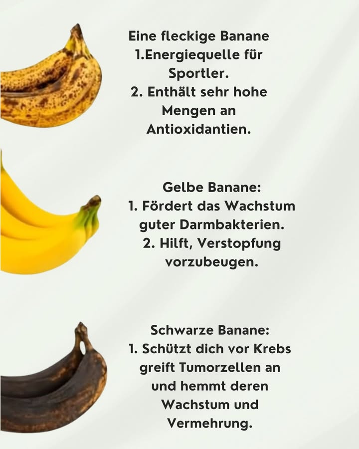 Die gesundheitlichen Vorteile von Bananen je nach Reifegrad 

Bananen sind ein beliebtes Obst, das weltweit genossen wird, und ihre verschiedenen Reifegrade bieten unterschiedliche gesundheitliche Vorteile. Je nachdem, ob die Banane grün, gelb oder braun ist, verändert sich die Nährstoffzusammensetzung und die Wirkung auf unseren Körper. Lassen Sie uns die Vorteile von Bananen in verschiedenen Reifestadien näher betrachten.

1. Eine fleckige Banane Braune Flecken

Wenn Bananen braune Flecken auf der Schale haben, sind sie überreif. Diese Bananen bieten jedoch viele gesundheitliche Vorteile:

Energiequelle für Sportler: Überreife Bananen sind reich an Zucker und daher eine schnelle Energiequelle. Sie eignen sich hervorragend als Snack vor oder nach dem Sport, um die Energiereserven schnell aufzufüllen.

Hoher Antioxidantiengehalt: Fleckige Bananen enthalten viele Antioxidantien, die dabei helfen, freie Radikale zu bekämpfen und die Zellen vor Schäden zu schützen. Diese Antioxidantien sind gut für die Haut und das allgemeine Wohlbefinden.

2. Gelbe Banane

Gelbe Bananen sind das, was die meisten von uns als reif kennen. Sie bieten ebenfalls viele gesundheitliche Vorteile:

Fördert das Wachstum guter Darmbakterien: Gelbe Bananen sind eine ausgezeichnete Quelle für Präbiotika, die das Wachstum von guten Bakterien im Darm unterstützen. Dies hilft, die Verdauung zu fördern und das Immunsystem zu stärken.

Hilft bei der Vorbeugung von Verstopfung: Der hohe Ballaststoffgehalt der gelben Banane trägt dazu bei, die Verdauung zu regulieren und Verstopfungen zu verhindern. Sie fördert die regelmäßige Entleerung des Darms und sorgt für ein angenehmes Gefühl der Erleichterung.

3. Schwarze Banane

Schwarze Bananen sind weit überreif und haben eine noch intensivere Süße und weiche Konsistenz. Diese Bananen bieten starke gesundheitliche Vorteile:

Schützt vor Krebs: Überreife Bananen, insbesondere schwarze Bananen, enthalten Antioxidantien und Verbindungen, die dazu beitragen, Krebszellen zu bekämpfen. Sie helfen, das Wachstum und die Vermehrung von Tumorzellen zu hemmen und unterstützen den Körper im Kampf gegen chronische Krankheiten.

Fazit:

Je nach Reifegrad bieten Bananen unterschiedliche gesundheitliche Vorteile. Ob eine fleckige, gelbe oder schwarze Banane  jede Stufe hat ihre eigenen positiven Eigenschaften. Daher ist es ratsam, alle Reifestadien von Bananen zu genießen, um die verschiedenen Nährstoffe und Vorteile optimal zu nutzen. Egal ob als schnelle Energiequelle, zur Unterstützung der Verdauung oder als Krebsprävention  Bananen sind ein gesundes und köstliches Lebensmittel, das in keiner Ernährung fehlen sollte.