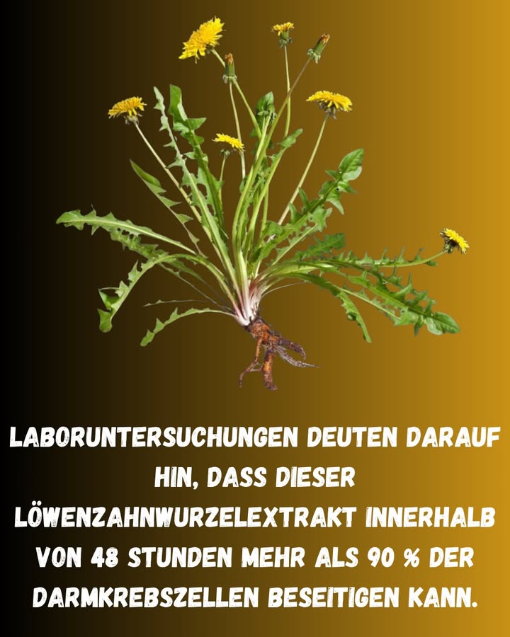Löwenzahnwurzel: Natürliche Energie und Gleichgewicht 

1 Die Wurzel des Löwenzahns enthält bioaktive Verbindungen mit starker antioxidativer und entzündungshemmender Wirkung, die die Zellen schützen und das Gleichgewicht des Körpers fördern.

2 Sie unterstützt die gesunde Leberfunktion, verbessert die Fettverdauung und trägt zur Entgiftung von Blut und Lymphsystem bei.

3 Außerdem hilft sie, den Stoffwechsel zu regulieren und eingelagerte Flüssigkeiten auszuleiten  was das Verdauungs- und Immunsystem stärkt.

4 Zubereitung: 4 Esslöffel getrocknete Löwenzahnwurzel in 1 Liter Wasser etwa 20 Minuten lang kochen, abseihen und bis zu 2 Tassen pro Tag trinken. 

 Eine traditionelle Pflanze mit bekannter Wirkung zur Reinigung, Stärkung und Vitalisierung des Körpers.