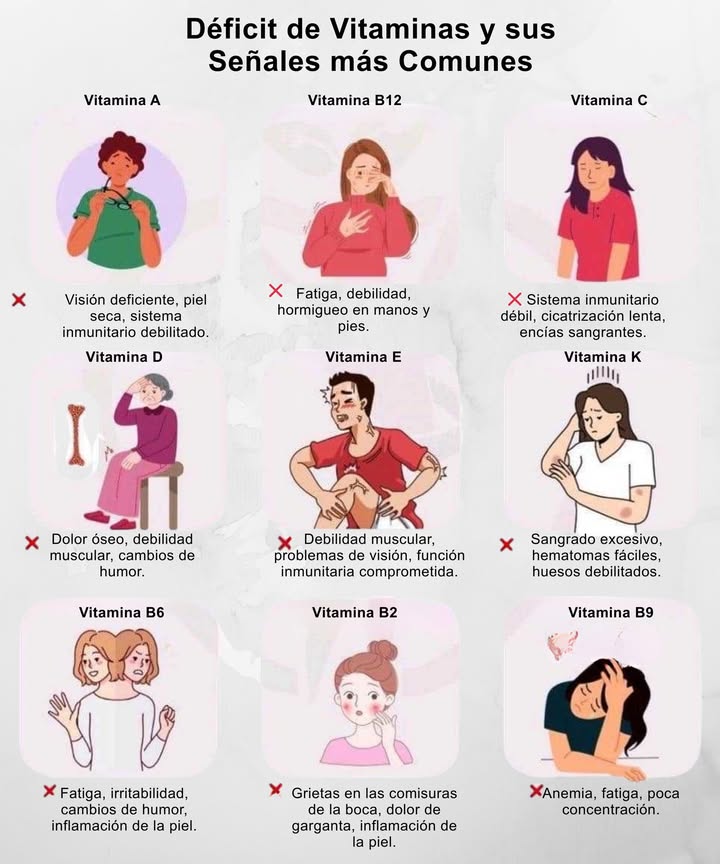 Déficit de Vitaminas y sus Señales más Comunes

 Vitamina A  Visión deficiente, piel seca, defensas bajas.
 Vitamina B12  Fatiga, debilidad, hormigueo en manos y pies.
 Vitamina C  Sistema inmunitario débil, cicatrización lenta, encías sangrantes.
 Vitamina D  Dolor óseo, debilidad muscular, cambios de humor.
 Vitamina E  Debilidad muscular, problemas de visión, inmunidad comprometida.
 Vitamina K  Sangrado excesivo, hematomas fáciles, huesos debilitados.
 Vitamina B6  Fatiga, irritabilidad, cambios de humor, inflamación de la piel.
 Vitamina B2  Grietas en las comisuras, dolor de garganta, inflamación de la piel.
 Vitamina B9 Ácido Fólico  Anemia, fatiga, poca concentración.