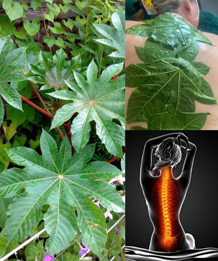 El poder de las hojas de ricino: un regalo oculto de la naturaleza

Las hojas de ricino, aunque menos conocidas que su aceite, han sido valoradas en muchas culturas por sus beneficios calmantes y curativos. Usadas de manera segura, ofrecen alivio natural para el cuerpo y son un recurso versátil en remedios caseros.

 15 beneficios de las hojas de ricino
 Alivian el dolor articular y la rigidez.
 Relajan músculos cansados.
 Reducen la hinchazón leve.
 Calman el dolor de espalda.
 Suavizan dolores de cabeza con aplicación en la frente.
 Calman irritaciones leves de la piel.
 Mejoran la circulación local con compresas calientes.
 Ayudan en resfriados al usarlas al vapor.
 Fortalecen el cabello como enjuague natural.
 Actúan como repelente de insectos.
 Relajan pies cansados en baños tibios.
 Calman calambres leves abdominales uso externo.
 Apoyo en la recuperación posparto en tradiciones populares.
 Alivian molestias leves de oído uso externo.
 Favorecen la relajación general en compresas tibias.

 Aviso de seguridad
Las semillas de ricino son altamente tóxicas y nunca deben consumirse. Las hojas, aunque más seguras, no deben ingerirse ni usarse en infusiones sin supervisión profesional. Limitar siempre su uso a aplicaciones externas y mantenerlas fuera del alcance de niños y mascotas.

 Usos caseros seguros
 Compresa tibia: hojas lavadas y calentadas aplicadas sobre articulaciones o espalda.
 Cataplasma: hojas trituradas envueltas en un paño sobre zonas inflamadas.
 Vapor: hojas en agua hirviendo para abrir vías respiratorias.
 Enjuague capilar: agua hervida con hojas para fortalecer raíces.
 Remojo de pies: agua de hojas hervidas para relajar y refrescar.
 Envoltura abdominal: hojas calientes sobre el vientre para calambres.

 Usadas con respeto y precaución, las hojas de ricino son un remedio tradicional que aporta alivio natural y bienestar.