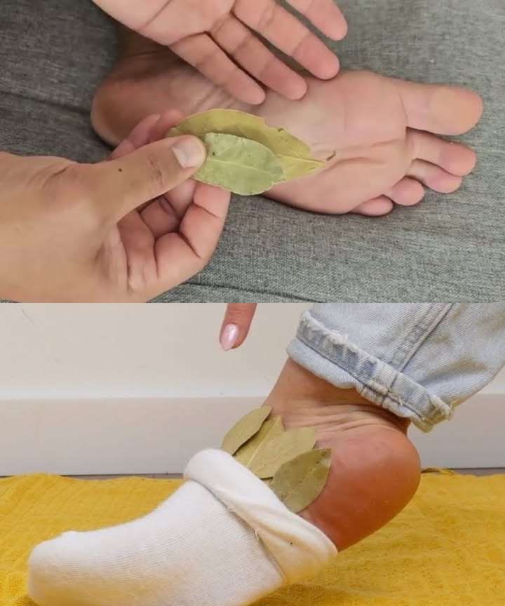 Hojas de laurel en los calcetines: un antiguo secreto para el bienestar 

El laurel, más allá de su uso culinario, es un tesoro medicinal lleno de propiedades antiinflamatorias y relajantes. Desde tiempos antiguos se ha utilizado para aliviar dolores articulares, musculares y de pies. Colocar una hoja de laurel dentro de los calcetines, cerca del talón, permite que sus compuestos naturales actúen durante el descanso, brindando alivio y equilibrio al cuerpo.

 Propiedades naturales
 Contiene eugenol, un potente antiinflamatorio natural.
 Calma el dolor muscular y articular.
 Favorece la circulación sanguínea.
 Posee efectos antimicrobianos que protegen los pies.
 Su aroma ayuda a relajar y conciliar un mejor sueño.

 Cómo aprovecharlo
1 Usa hojas limpias y secas.
2 Coloca una hoja dentro de cada calcetín, cerca del talón.
3 Úsalos durante la noche o algunas horas del día mientras descansas.
4 Repite a diario para notar alivio progresivo.

 Consejo extra
Combina el uso del laurel en los calcetines con infusiones o baños de pies con hojas de laurel para potenciar el efecto calmante.

 Un gesto pequeño con grandes resultados: bienestar, descanso y armonía natural.