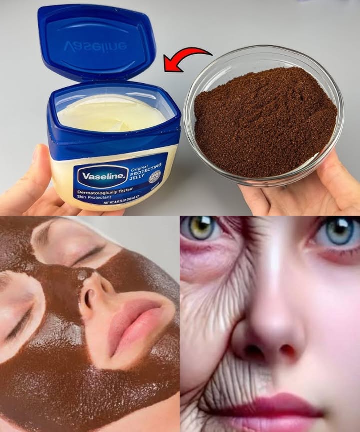 Mascarilla facial de café y vaselina: piel hidratada y radiante naturalmente 

La combinación de café y vaselina es uno de esos secretos caseros que miman la piel sin gastar mucho. Una mezcla sencilla que hidrata profundamente, suaviza la textura y aporta un brillo saludable.

 Beneficios del café para la piel
 Exfolia suavemente y elimina células muertas.
 Activa la circulación, dando un efecto firme y luminoso.
 Aporta antioxidantes que combaten el envejecimiento prematuro.
 Reduce bolsas y la hinchazón gracias a su acción antiinflamatoria.

 Beneficios de la vaselina
 Hidrata en profundidad creando una barrera protectora.
 Suaviza líneas de expresión y mejora la elasticidad.
 Calma y repara la piel seca o irritada.
 Protege frente al frío, la contaminación y el viento.

林 Cómo prepararla
Ingredientes:
 1 cucharadita de café molido fino.
 1 cucharadita de vaselina.

Modo de uso:
 Mezcla ambos ingredientes hasta obtener una pasta homogénea.
 Aplica una capa fina en el rostro evitando el contorno de ojos.
 Deja actuar 1015 minutos.
 Masajea con movimientos circulares para exfoliar y enjuaga con agua tibia.
 Seca con suavidad y aplica una crema ligera para sellar la hidratación.

 Resultados visibles
La piel queda más suave, luminosa y nutrida. Las líneas finas se disimulan gracias a la hidratación intensa y al impulso de circulación que da el café.

 Extra para potenciar el efecto antiedad:
 Gel de aloe vera para más elasticidad.
 Aceite de vitamina E para reparar.
 Miel para mayor suavidad y frescura.

 Evita esta mascarilla si tienes:
 Piel grasa o con acné la vaselina puede obstruir poros.
 Piel sensible a los exfoliantes.

 Una receta simple y natural que deja la piel radiante, hidratada y llena de vida.
#MascarillaCasera #CuidadoNatural #CaféParaLaPiel