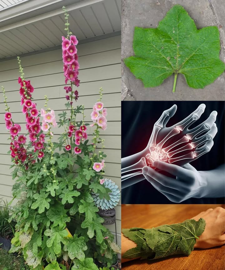 El poder curativo de las hojas de malvarrosa Alcea para las articulaciones

Las malvarrosas Alcea son conocidas por su elegancia en los jardines, pero sus hojas también guardan un valor terapéutico. Ricas en mucílago y compuestos naturales, se han utilizado durante siglos para calmar el dolor, la rigidez y la inflamación de las articulaciones.

 Por qué alivian las articulaciones

Mucílago: efecto calmante sobre tejidos irritados.

Antioxidantes y fitonutrientes: reducen el estrés oxidativo.

Efecto refrescante: alivio inmediato en zonas inflamadas.

 Usos externos tradicionales

Cataplasma calmante  hojas frescas ablandadas en agua tibia, aplicadas directamente sobre la articulación y cubiertas con un paño.

Compresa herbal  hojas hervidas y envueltas en tela limpia, colocadas en caliente sobre la zona dolorida.

Aceite infusionado  hojas secas maceradas en aceite de oliva o girasol, aplicadas con suaves masajes en articulaciones rígidas.

Baño relajante  hojas trituradas o secas en agua caliente, añadidas al baño para aliviar tensión y molestias.

 Precauciones

Solo uso externo, no ingerir.

Probar antes en una pequeña zona de piel.

No sustituye un tratamiento médico.

 Más que flores ornamentales, las malvarrosas son aliadas naturales contra la incomodidad articular, uniendo belleza y medicina tradicional en una sola planta.
