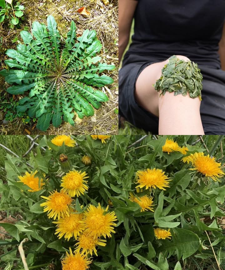 El poderoso diente de león: el tesoro oculto de la naturaleza 

Más que una mala hierba, el diente de león Taraxacum officinale es un superalimento ancestral que nutre, depura y fortalece el cuerpo. Cada parte raíz, hojas y flores encierra beneficios únicos que lo convierten en un verdadero regalo natural.

1 Propiedades principales
 Rico en antioxidantes: combate radicales libres y retrasa el envejecimiento.
 Fortalece el sistema inmunitario y desintoxica el hígado.
 Mejora la digestión y favorece la salud renal y biliar.
 Potente diurético natural, reduce la retención de líquidos.
 Regula el azúcar en sangre y ayuda a equilibrar las hormonas.

2 Beneficios para todo el cuerpo
 Favorece la pérdida de peso y el metabolismo saludable.
 Aporta vitaminas A, C y K, esenciales para piel, visión y huesos.
 Combate la anemia, fortalece los dientes y mejora la memoria.
 Reduce la inflamación articular y el colesterol.
 Apoya la salud del corazón, del cabello y de la piel.

3 Usos tradicionales y modernos
 Hojas: en ensaladas, salteadas o infusiones.
 Flores: para tés, bálsamos o aceites calmantes.
 Raíces: tostadas como café de diente de león o en tinturas medicinales.

4 Formas de aprovecharlo
 Infusión depurativa: hojas secas  agua caliente 10 min.
 Bálsamo calmante: flores infusionadas en aceite.
 Café herbal: raíces tostadas y molidas, sin cafeína.

5 Precauciones
Personas con alergias a la ambrosía, tratamientos diuréticos o problemas biliares deben consultar a un profesional antes de usarlo con frecuencia.

 Conclusión
El diente de león es símbolo de resiliencia y salud natural: limpia por dentro, embellece por fuera y revitaliza desde la raíz. Una joya silvestre que merece volver al centro del bienestar cotidiano.