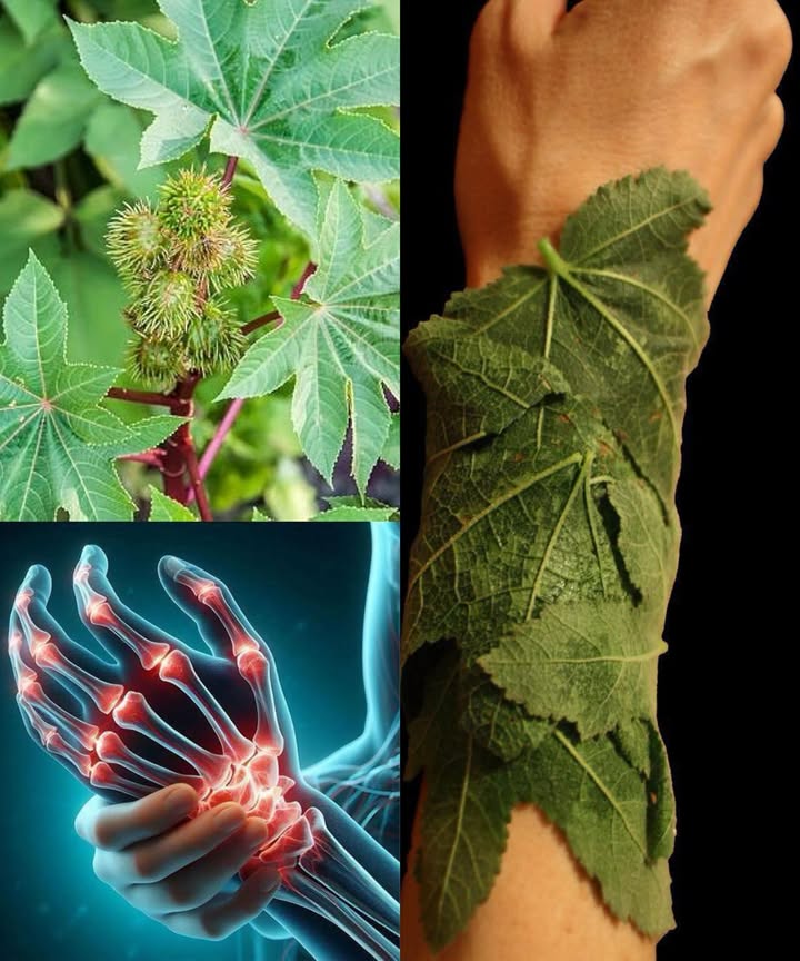 10 poderosos beneficios de las hojas de ricino que transforman tu bienestar

 Las hojas de ricino Ricinus communis, conocidas por sus propiedades antiinflamatorias, antibacterianas y desintoxicantes, son un antiguo remedio natural usado en muchas culturas.
 Actúan sobre la piel, los músculos y los órganos internos, ayudando a sanar, desinflamar y revitalizar el cuerpo.

1 Alivian el dolor articular y muscular  Aplicadas tibias, reducen la inflamación y calman el dolor de artritis y contracturas.
2 Favorecen la desintoxicación natural  Estimulan el drenaje linfático y apoyan al hígado en la eliminación de toxinas.
3 Aceleran la cicatrización de heridas  Sus compuestos antibacterianos previenen infecciones y facilitan la curación.
4 Reducen cólicos menstruales  Compresas tibias sobre el abdomen ayudan a relajar los músculos y aliviar el malestar.
5 Fortalecen el cabello  Enjuagues de hojas hervidas nutren los folículos y estimulan el crecimiento capilar.
6 Apoyan la lactancia  Aplicadas sobre los senos, mejoran el flujo de leche y alivian la congestión.
7 Desinflaman y calman picaduras  Alivian hinchazones, esguinces o reacciones cutáneas gracias a su efecto refrescante.
8 Despejan las vías respiratorias  El vapor de hojas hervidas ayuda a aliviar la tos y la congestión.
9 Cuidan la piel  Calman irritaciones por eccema, acné o tiña, restaurando la salud cutánea.
 Favorecen la digestión  Las infusiones suaves estimulan el tránsito intestinal y alivian la hinchazón.

 Precaución: la planta contiene ricina, una sustancia tóxica presente sobre todo en las semillas. Usa las hojas solo de forma externa y con conocimiento adecuado.

 Un remedio ancestral que combina curación, belleza y equilibrio natural, recordando el poder silencioso de las plantas medicinales.