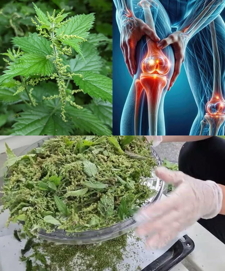 El poder curativo de la ortiga: alivio natural para articulaciones y artritis

Bajo su aspecto punzante, la ortiga mayor Urtica dioica esconde una enorme fuerza medicinal. Rica en compuestos antiinflamatorios, minerales y antioxidantes, es una aliada ancestral contra el dolor articular, la artritis y la inflamación crónica.

 Propiedades principales:
1 Antiinflamatoria natural: contiene quercetina y ácidos fenólicos que reducen citocinas inflamatorias, calmando hinchazón y rigidez.
2 Alivio del dolor: actúa sobre los receptores del dolor, similar a los AINE pero sin efectos secundarios.
3 Desintoxicante suave: ayuda a eliminar toxinas y ácido úrico, útil en casos de gota.
4 Rica en minerales: calcio, magnesio, sílice y boro fortalecen huesos, cartílagos y músculos.
5 Bloquea enzimas inflamatorias COX-1 y COX-2: disminuye la inflamación de forma natural.
6 Efecto inmunomodulador: equilibra la respuesta del sistema inmunitario en artritis autoinmune.

 Formas de uso:
 Té de ortiga: infusiona 12 cucharaditas de hojas secas en agua caliente 1015 min.
 Cápsulas o extractos: 300500 mg diarios según el envase.
 Aceite o ungüento: macera ortiga seca en aceite de oliva 24 semanas; aplica en articulaciones.
 Polvo de ortiga: añade 1 cucharadita a batidos o sopas.
 Aplicación directa: pasa suavemente hojas frescas con guantes sobre la zona dolorida; el escozor activa la circulación y alivia el dolor.

 Consejo extra: combina ortiga con diente de león o perejil en infusión para potenciar la eliminación de toxinas.

 Precaución:
Consulta a un profesional antes de usarla si tomas anticoagulantes, diuréticos o medicamentos antidiabéticos. Evítala durante el embarazo o lactancia sin orientación médica.

 Resultado: articulaciones más flexibles, menos dolor y una sensación de bienestar natural y duradera.