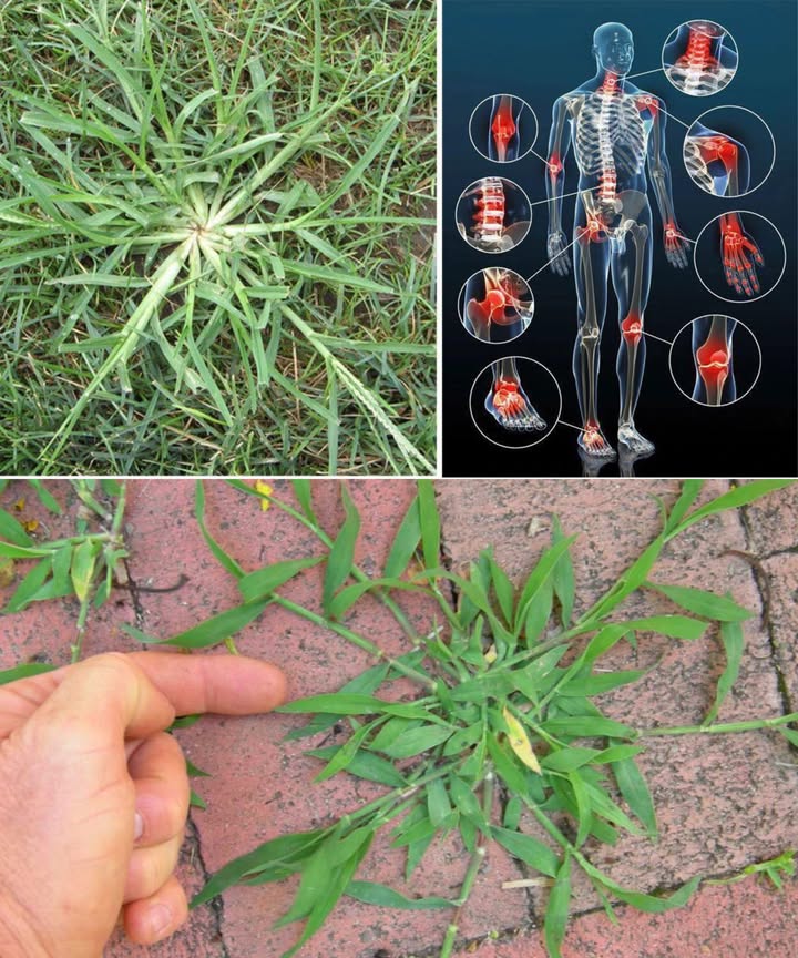 La hierba cangrejo: una maleza que se convierte en medicina natural.
Resistente, adaptable y abundante en jardines y campos, esta planta humilde esconde un verdadero tesoro para la salud. Hojas, tallos y raíces concentran compuestos que apoyan la digestión, la desintoxicación y reducen la inflamación.
 Beneficios sorprendentes de la hierba cangrejo
 Antiinflamatoria natural
Alivia dolor articular, muscular y de garganta con té de hojas y tallos frescos.
 Diurético suave
Favorece la función renal y ayuda a eliminar toxinas, combatiendo la retención de líquidos.
 Mejora la digestión
Alivia hinchazón, indigestión y favorece la regularidad intestinal.
 Cuidado de la piel
Cataplasmas de hojas frescas calman irritaciones, picaduras y erupciones leves.
 Apoyo respiratorio
Té que despeja vías respiratorias y facilita la respiración durante resfriados leves.
 Control de la fiebre
Propiedades refrescantes que ayudan a bajar la temperatura corporal.
 Rica en antioxidantes
Protege contra radicales libres, estrés oxidativo y enfermedades crónicas.
 Regula azúcar en sangre
Contribuye a mantener estables los niveles de glucosa.
 Fortalece el sistema inmune
Compuestos beneficiosos que refuerzan las defensas naturales del organismo.
 Salud cardiovascular
Ayuda a relajar los vasos sanguíneos, favoreciendo la circulación y manteniendo la presión arterial saludable.
 Apoyo a la desintoxicación
Elimina toxinas y mejora la función hepática y renal de forma natural.
 Cómo aprovechar la hierba cangrejo
 Infusión interna: Hervir un puñado de hojas y tallos en medio litro de agua durante 5 minutos. Tomar 1-2 tazas al día para digestión, inflamación o fiebre.
 Uso externo: Triturar hojas frescas y aplicar sobre irritaciones o heridas leves para calmar y favorecer la cicatrización.
La hierba cangrejo demuestra que incluso las plantas más comunes pueden transformarse en aliados para la salud. Incorporarla a tu rutina diaria convierte un problema del jardín en un recurso natural lleno de beneficios.