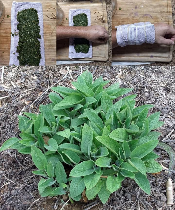 Consuelda común: una aliada natural para huesos, piel y articulaciones 

La consuelda común Symphytum officinale, también llamada hierba que suelda los huesos, es una planta medicinal potente con siglos de uso tradicional. Favorece la regeneración celular, calma el dolor y mejora la salud de la piel.

 Principales beneficios:

Regenera huesos y articulaciones gracias a la alantoína.

Reduce dolor e inflamación muscular.

Favorece la cicatrización de heridas y cortes leves.

Calma irritaciones por eccema, picaduras o psoriasis.

Hidrata y repara la piel seca.

Acelera la recuperación de hematomas y quemaduras leves.

Mejora la circulación y alivia venas varicosas.

Fortalece el cabello y cuero cabelludo.

林 Usos externos seguros:

Cataplasma: hojas trituradas  agua tibia, aplicar 30 min.

Aceite de consuelda: hojas secas en aceite de oliva o coco, infundir 2-3 semanas.

Ungüento: mezcla aceite de consuelda con cera de abejas.

Compresa: hojas hervidas 5 min, aplicar con paño tibio.

Enjuague capilar: infusión fría como último aclarado.

 Precauciones:

Solo uso externo.

No aplicar en heridas profundas ni en piel agrietada.

Evitar en embarazo o lactancia.

No usar por periodos prolongados: aplicar durante unas semanas y descansar.

 Nota:
La consuelda contiene alcaloides pirrolizidínicos, tóxicos por ingestión. No consumirla internamente.

 Usada con prudencia, la consuelda es una joya de la fitoterapia que apoya la curación natural del cuerpo.