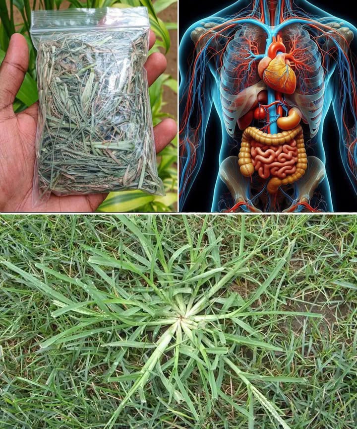 El poder curativo de la hierba de ganso: usos y preparación natural 

La hierba de ganso Galium aparine es una joya escondida entre las plantas silvestres. Conocida por su acción depurativa, diurética y calmante, es un remedio natural ideal para limpiar el organismo y cuidar la piel de forma suave y efectiva.

 Cómo reconocerla y recolectarla
 Tallos delgados y alargados cubiertos de finos pelillos que se adhieren a la ropa.
 Pequeñas flores blanco verdosas.
 Cosecha ideal: primavera, antes de la floración, cuando los brotes son tiernos.

 Preparación medicinal
 Lava bien las hojas para eliminar restos de tierra.
 Úsala fresca o sécala colgando manojos en un lugar ventilado y sin sol directo.
 Para el té: infusiona 2 cucharaditas de hierba seca en agua hirviendo por 10 minutos.
 Bebe hasta tres veces al día para purificar la sangre y estimular el sistema linfático.

 Usos terapéuticos
 Piel e irritaciones: machaca hojas frescas y aplícalas sobre heridas, eccemas o zonas inflamadas. Calma, regenera y desinfecta.
 Riñones y vías urinarias: su efecto diurético ayuda a eliminar toxinas, prevenir cálculos y aliviar infecciones.
 Sistema linfático: mejora la circulación linfática, reduce hinchazones y fortalece la inmunidad.

 Beneficios extra
 Favorece la pérdida de peso al estimular el metabolismo y eliminar líquidos retenidos.
 Aporta brillo y fuerza al cabello: usa una decocción como enjuague capilar natural.

 Precauciones
 Realiza una prueba en la piel antes de usarla tópicamente.
 Consulta con un profesional si tomas medicación o tienes enfermedades previas.

 Una planta humilde con grandes poderes. La hierba de ganso limpia, equilibra y revitaliza de manera natural, convirtiéndose en una aliada perfecta para la salud y el bienestar diario.

#HierbaDeGanso #PlantasMedicinales