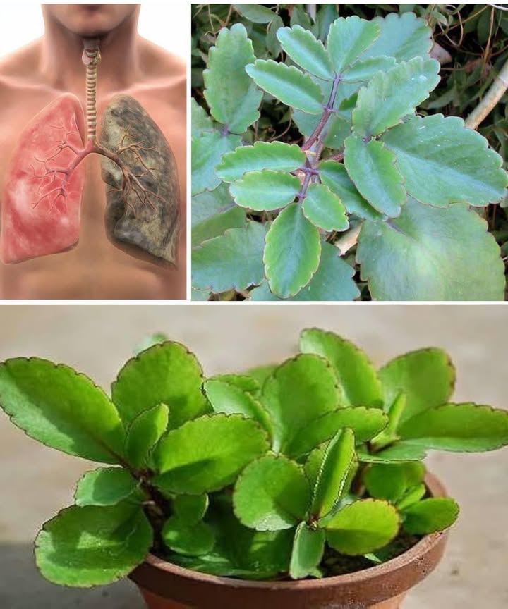 11 sorprendentes beneficios de la Hoja Milagrosa de la Vida Bryophyllum pinnatum
Una planta ancestral apreciada por su poder medicinal y su profunda conexión con la salud natural.

 Salud respiratoria
Alivia asma, bronquitis y tos persistente, aportando calma y claridad a las vías respiratorias.

 Cicatrización de heridas
Sus hojas antimicrobianas aceleran la recuperación de cortes, quemaduras y lesiones.

 Acción antiviral y antibacteriana
Flavonoides y ácidos fenólicos ayudan a combatir virus y bacterias comunes.

 Efecto antiinflamatorio
Reduce inflamación y rigidez en casos de artritis o reumatismo, brindando alivio natural.

 Equilibrio digestivo
Favorece la digestión y calma molestias estomacales e intestinales.

 Prevención de cálculos renales
Su extracto contribuye a disolver cálculos y favorecer su expulsión.

 Refuerzo del sistema inmunitario
Rica en antioxidantes que fortalecen las defensas y protegen contra el estrés oxidativo.

 Cuidado de la piel
Calma irritaciones, mejora eccema, psoriasis y acné, y favorece la regeneración cutánea.

 Alivio del dolor
Reduce molestias musculares, articulares y cefaleas gracias a sus propiedades antiinflamatorias.

 Regulación del azúcar en sangre
Ayuda a estabilizar los niveles de glucosa de manera natural.

 Apoyo cardiovascular
Contribuye a reducir presión arterial y colesterol, favoreciendo una circulación saludable.

 Nota importante
Su uso debe ser responsable y guiado por un profesional de la salud, especialmente en embarazo, lactancia, enfermedades previas o tratamientos farmacológicos.

 Una planta versátil y poderosa que ofrece bienestar integral desde la naturaleza.