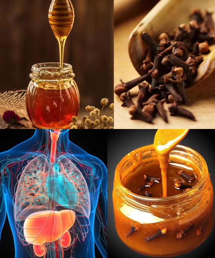 Miel con clavo: un elixir natural de bienestar que puedes preparar en casa

La combinación de miel cruda y clavo de olor crea una infusión poderosa con siglos de tradición. Este tónico natural aporta calidez, energía y propiedades antibacterianas, ideal para fortalecer el cuerpo, cuidar la digestión y aliviar molestias respiratorias.

 Principales beneficios:

Refuerza las defensas naturales gracias a sus antioxidantes.

Calma la garganta y las vías respiratorias.

Favorece la digestión y alivia la hinchazón.

Cuida la salud bucal y refresca el aliento.

Estimula la circulación y aporta energía.

Protege frente al estrés oxidativo diario.

Mejora el metabolismo y la vitalidad.

Ayuda a reducir náuseas leves.

Calma la tensión y la presión de cabeza.

Contribuye al alivio natural de molestias leves.

龎 Cómo prepararla:
Ingredientes:
 1 taza de miel cruda
 12 cucharadas de clavos de olor enteros

Instrucciones:

Coloca los clavos en un frasco de vidrio limpio.

Calienta la miel suavemente sin hervir.

Vierte sobre los clavos y mezcla.

Cierra herméticamente y deja reposar 12 semanas en lugar fresco y oscuro.

Agita cada dos días.

Cuela los clavos o déjalos para una infusión más intensa.

 Cómo usarla:
 Bienestar diario: 1 cucharadita en ayunas.
 Garganta y tos: disuelve en agua o té caliente.
 Digestión: 1 cucharadita antes de las comidas.
 Cuidado bucal: deja que se derrita lentamente en la boca.
 Relajación nocturna: mezcla con leche tibia o leche dorada.
 Edulcorante natural: añade a batidos, avena o agua con limón.

 Consejos:
 Guarda en frasco cerrado, lejos del calor y la luz.
 Dura entre 6 y 12 meses.
 Si cristaliza, coloca el frasco en agua tibia no hirviendo.

 Precauciones:
 No apta para bebés menores de 12 meses.
 Evita si eres alérgico al clavo o la miel.
 Moderar en embarazo, lactancia o si padeces reflujo.
 Controlar su uso en caso de diabetes.

 Resultado: un remedio casero aromático, cálido y revitalizante, perfecto para fortalecer el cuerpo y reconfortar el espíritu con la dulzura y las especias de la naturaleza.