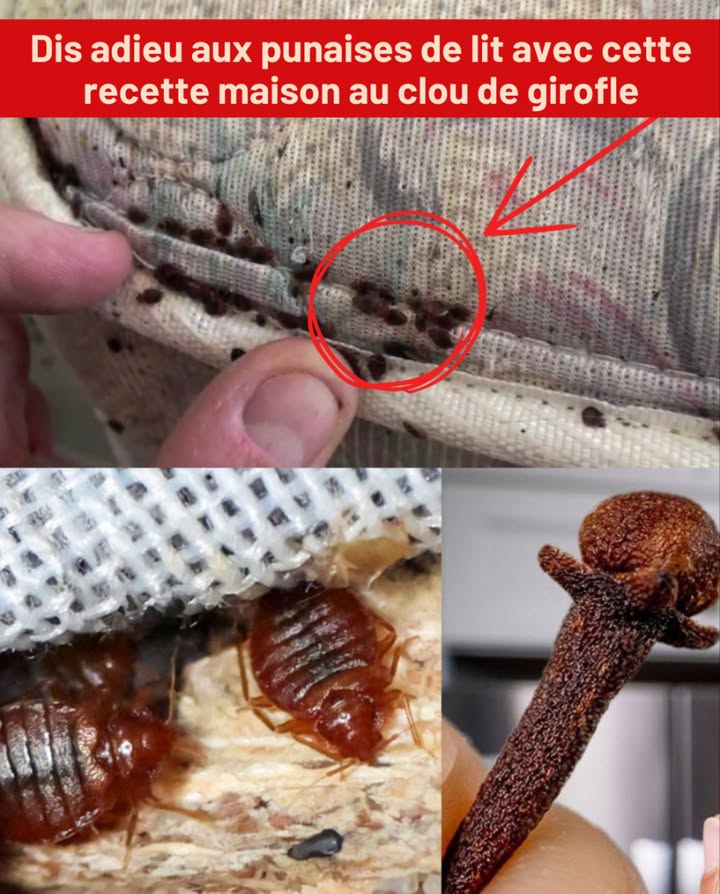 Dis adieu aux punaises de lit avec cette recette maison au clou de girofle 

蓼 Ingrédients simples mais puissants :

 1 tasse deau
 1 cuillère à soupe dhuile essentielle de clou de girofle
林 1 flacon vaporisateur

離 Préparation et application :

 Mélange leau et lhuile essentielle dans le vaporisateur
欄 Agite bien pour bien homogénéiser
 Vaporise sur le matelas, les coutures, les coins et les fissures
 Répète toutes les 48 à 72 heures jusquà élimination complète

 Le clou de girofle agit comme un insecticide naturel, au parfum puissant et à leffet répulsif durable.
 Une solution sûre, économique et efficace pour protéger ta maison naturellement.