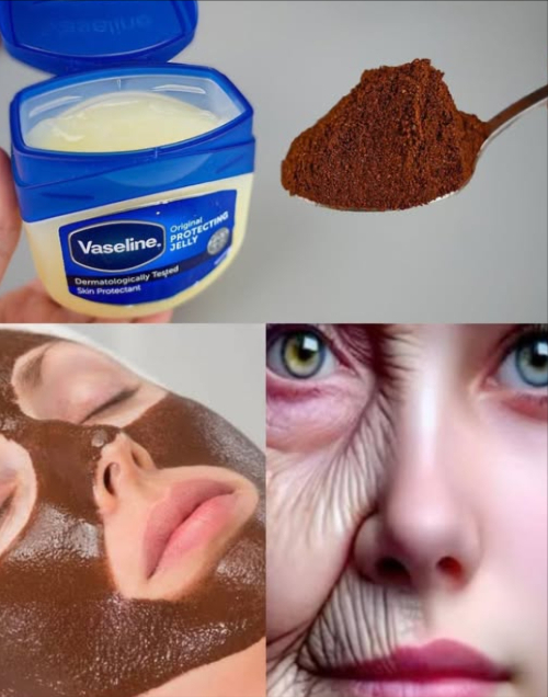 Masque au café et à la vaseline : peau douce, hydratée et lumineuse 

Ingrédients
 1 c. à café de café finement moulu
 1 c. à café de vaseline

Préparation
1 Mélangez les deux ingrédients dans un petit bol jusquà obtenir une pâte homogène.
2 Appliquez une fine couche uniforme sur le visage en évitant le contour des yeux.
3 Laissez agir 10 à 15 minutes.
4 Massez en mouvements circulaires pour exfolier en douceur.
5 Rincez à leau tiède et séchez délicatement.
6 Appliquez une crème hydratante légère si souhaité.

Bienfaits
 Exfoliation douce et naturelle
 Stimule la circulation sanguine
 Hydrate et retient lhumidité
 Atténue lapparence des rides fines

 À utiliser 1 à 2 fois par semaine pour une peau fraîche, lisse et éclatante.
#SoinsVisage #BeautéNaturelle #MasqueMaison