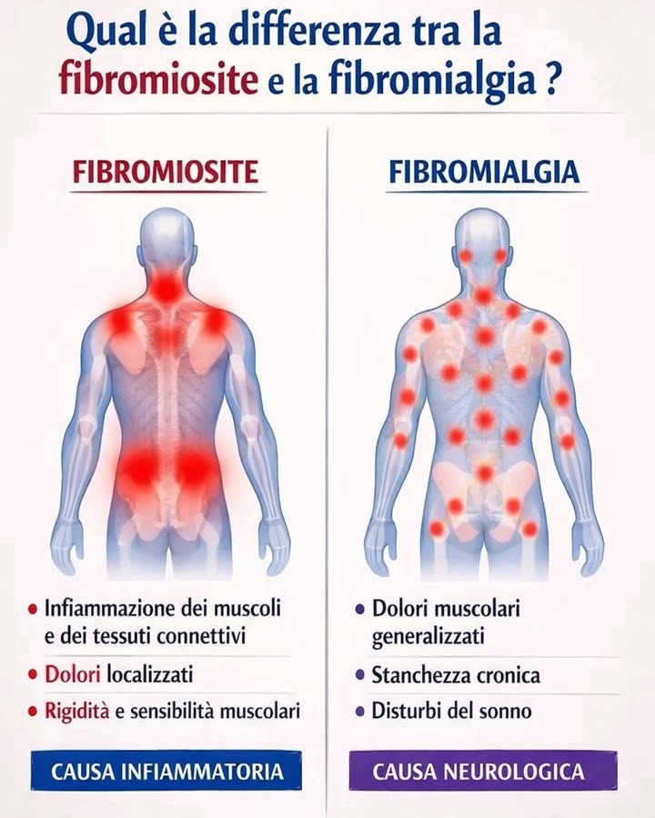 喙 Fibromiosite o Fibromialgia? 
Spesso questi due termini vengono confusi perché entrambi coinvolgono dolori muscolari. In realtà si tratta di condizioni diverse per origine, sintomi e modalità di gestione.
 Fibromiosite: origine infiammatoria
È legata a uninfiammazione dei muscoli e dei tessuti connettivi. Il dolore è generalmente localizzato in aree specifiche del corpo, come collo, spalle o zona lombare.
 Dolore localizzato e rigidità
Si manifesta con rigidità muscolare e sensibilità al tatto nelle zone colpite. Il fastidio tende a concentrarsi in punti precisi.
 Fibromialgia: origine neurologica
Non è causata da uninfiammazione, ma da unalterazione nella percezione del dolore da parte del sistema nervoso. Il dolore è diffuso e coinvolge diverse aree del corpo.
 Dolore generalizzato e sintomi associati
Oltre ai dolori muscolari diffusi, possono comparire stanchezza cronica e disturbi del sonno. I punti dolorosi sono multipli e distribuiti in modo più esteso.
Comprendere la differenza tra fibromiosite e fibromialgia permette di interpretare meglio i sintomi e di orientarsi verso un percorso di gestione più adeguato, con maggiore consapevolezza della propria salute.